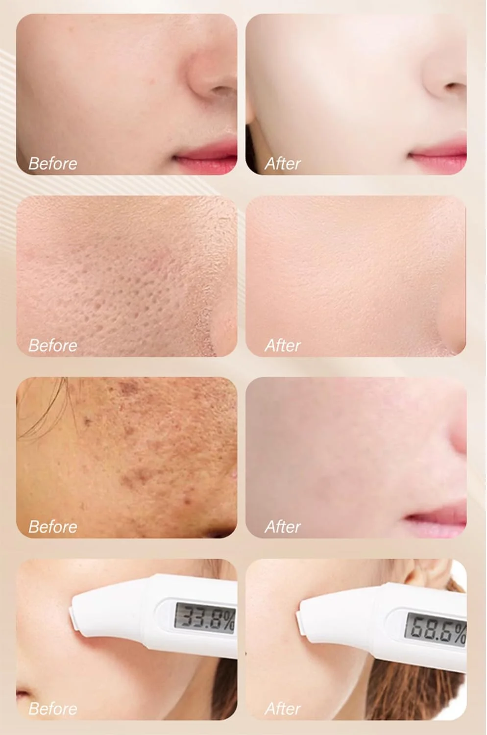 سرم صورت ویتامین C لیمو سبز با نیاسینامید - مراقبت از لک سبک و آبرسان - سرم صورت 30 میلی لیتری برای پوستی صاف تر