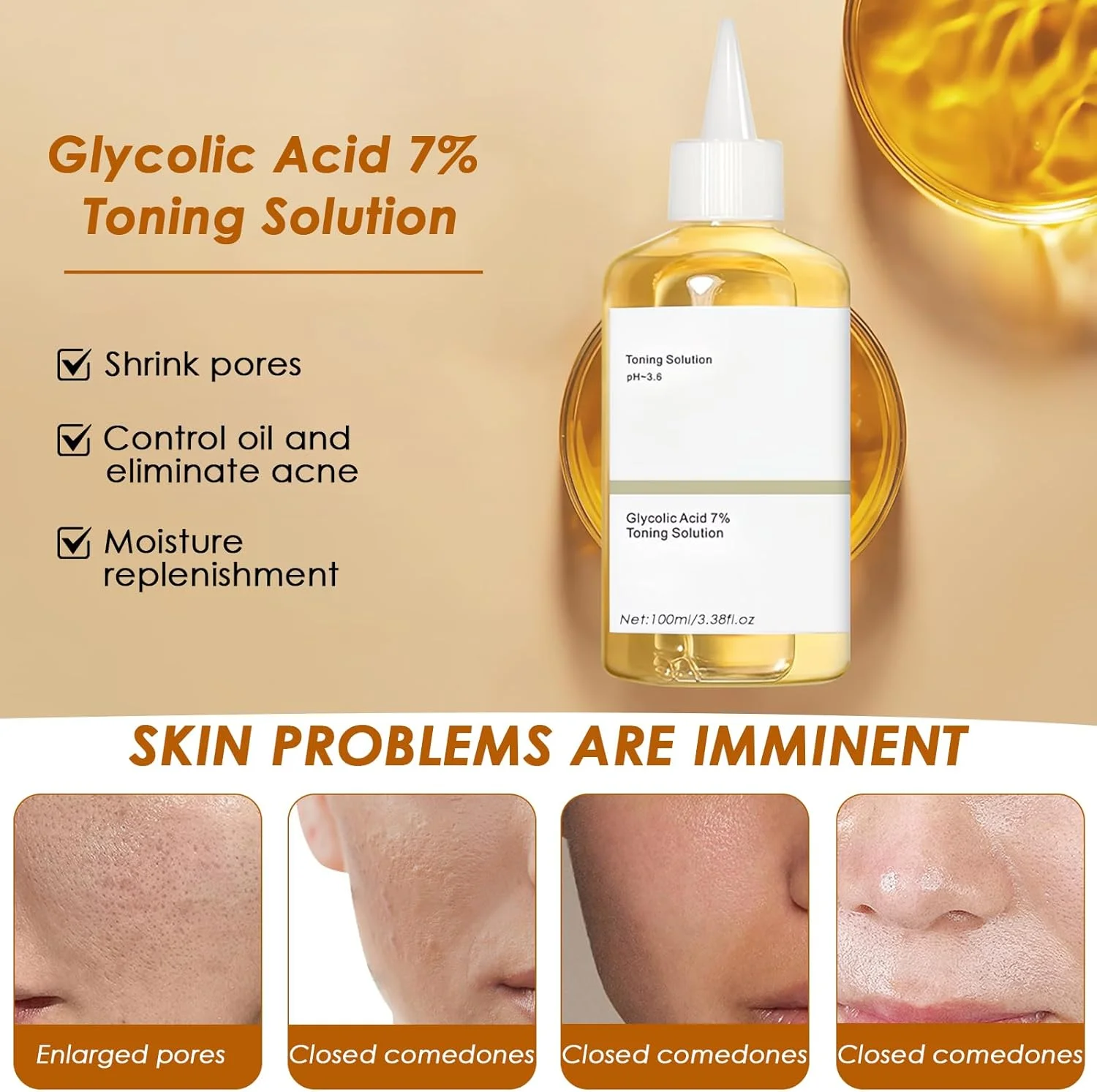 محلول تونر حاوی 7% گلیکولیک اسید، محلول لایه بردار گلیکولیک اسید، تونر لایه بردار، سرم مراقبت از پوست مرطوب کننده و لایه بردار صورت (نوع 2)