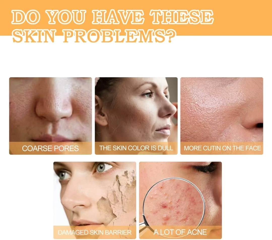 تونر گلیکولیک اسید صورت Mimi & Beibei حجم 100 میلی لیتر، تونر لایه بردار صورت با 7% گلیکولیک اسید، کوچک کننده منافذ، لایه بردار صورت آبرسان، کاهش دهنده لک های پوستی، پوست صاف، محلول تونینگ ضد پیری