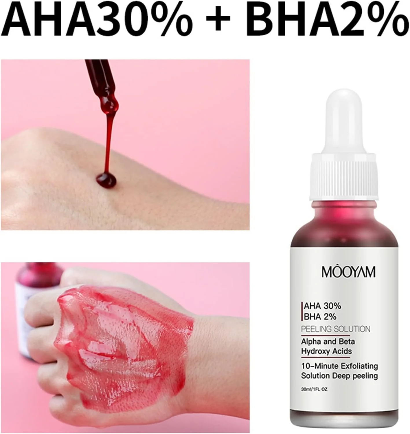 محلول لایه بردار حاوی 30% AHA و 2% BHA، بهبود آکنه، کنترل چربی و لایه برداری پوست صورت، 30 میلی لیتر