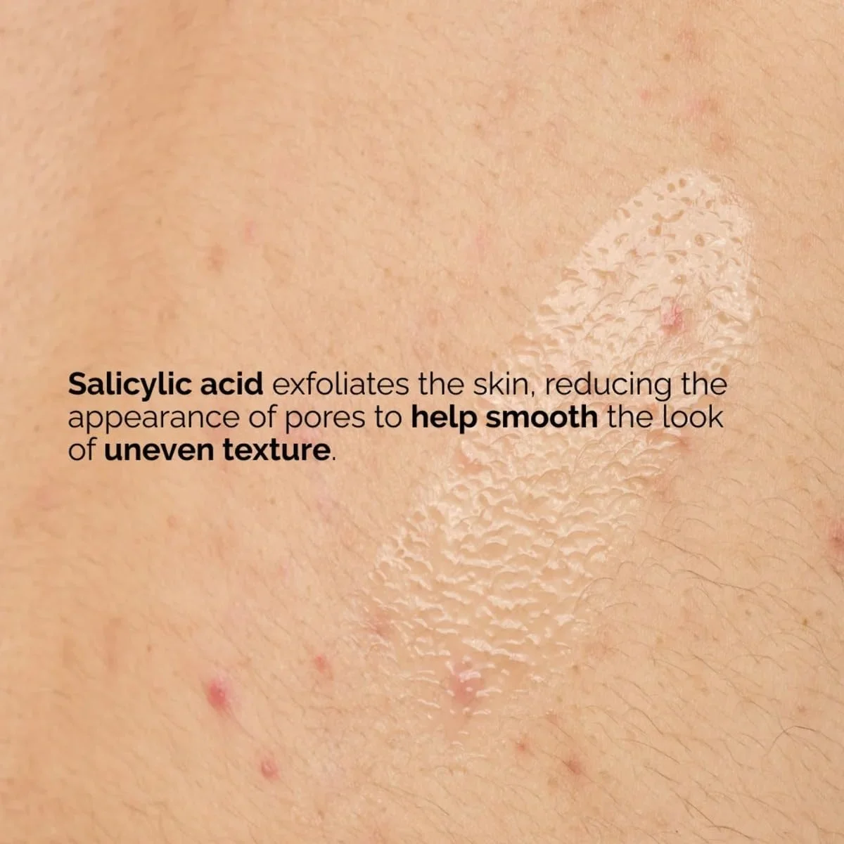 سرم بدن حاوی اسید سالیسیلیک 0.5% اوردینری (240 میلی لیتر) - لایه بردار برای نرم کردن پوست زبر و ناهموار و بهبود بافت پوست از گردن تا انگشتان پا سرم بدن حاوی اسید سالیسیلیک 0.5% اوردینری (240 میلی لیتر) - لایه بردار برای نرم کردن پوست زبر و ناهموار و بهبود بافت پوست از گردن تا انگشتان پا