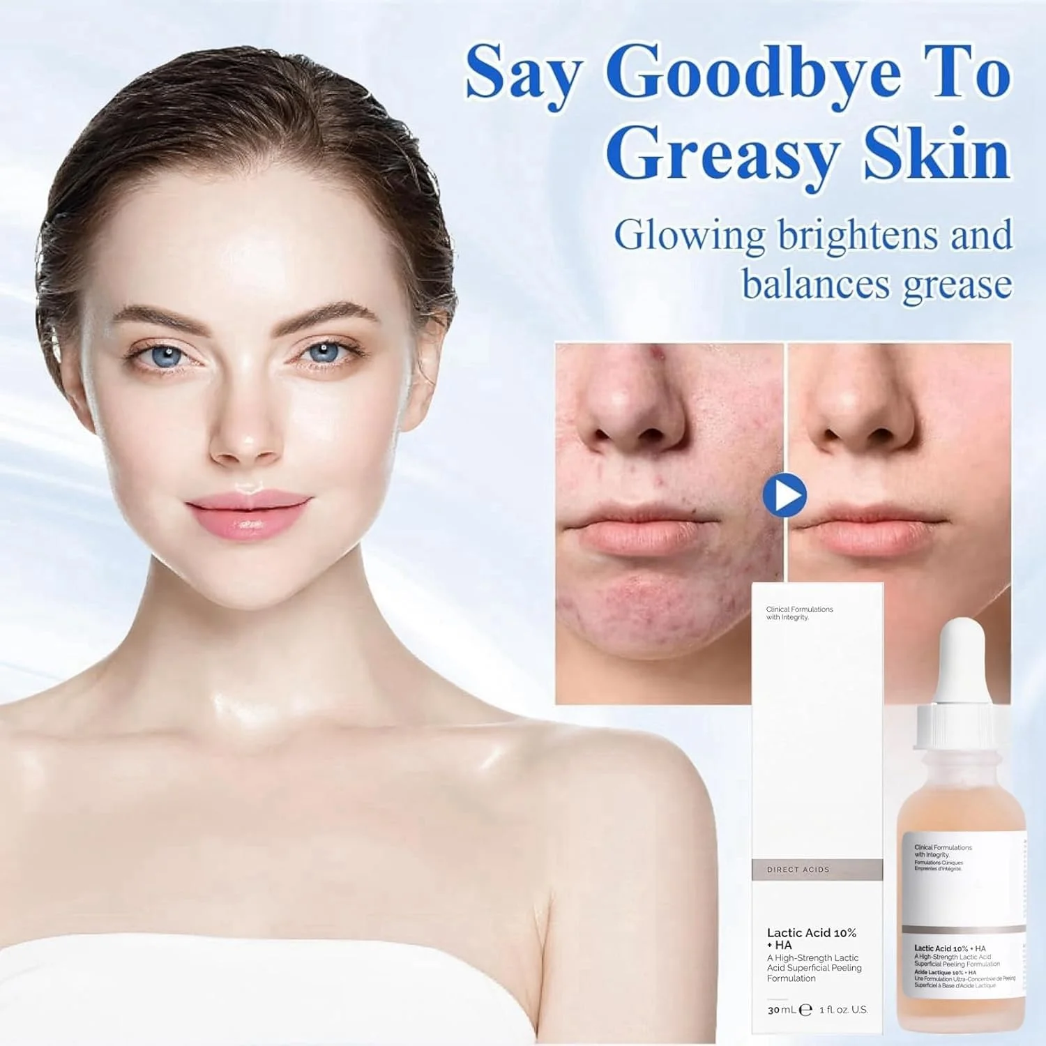 سرم لایه بردار 10% اسید لاکتیک + 10% اسید هیالورونیک برای بستن منافذ، مرطوب کننده، آنتی اکسیدان، کنترل چربی، روشن کننده و آبرسان پوست، سرم صورت، 30 میلی لیتر سرم لایه بردار 10% اسید لاکتیک + 10% اسید هیالورونیک برای بستن منافذ، مرطوب کننده، آنتی اکسیدان، کنترل چربی، روشن کننده و آبرسان پوست، سرم صورت، 30 میلی لیتر