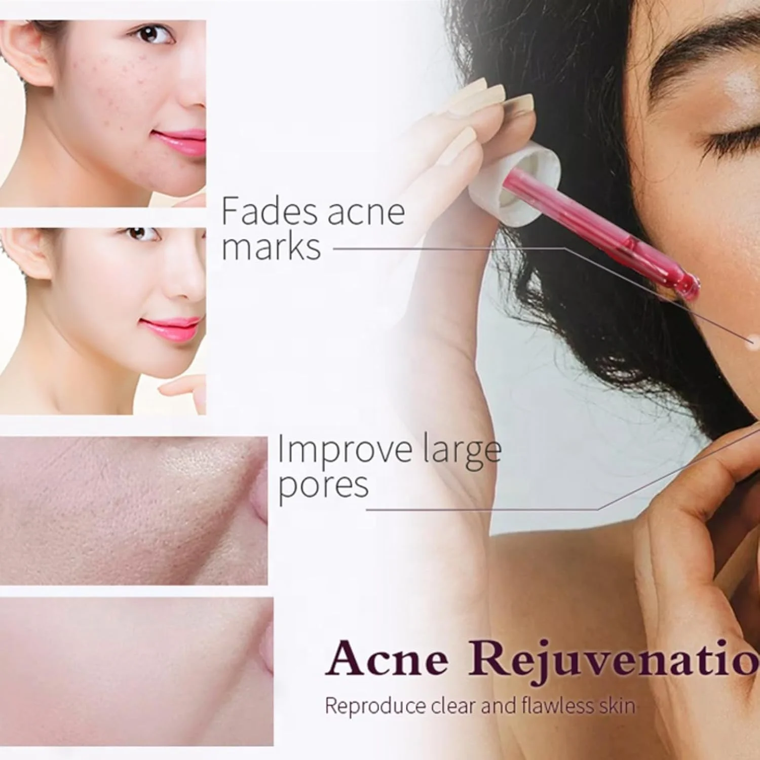 محلول لایه بردار صورت قرمز، سرم لایه بردار AHA 30% + BHA 2% برای مبارزه با لک ها، کاهش تراکم منافذ و خطوط ریز، محلول لایه بردار صورت AHA محلول لایه بردار صورت قرمز، سرم لایه بردار AHA 30% + BHA 2% برای مبارزه با لک ها، کاهش تراکم منافذ و خطوط ریز، محلول لایه بردار صورت AHA