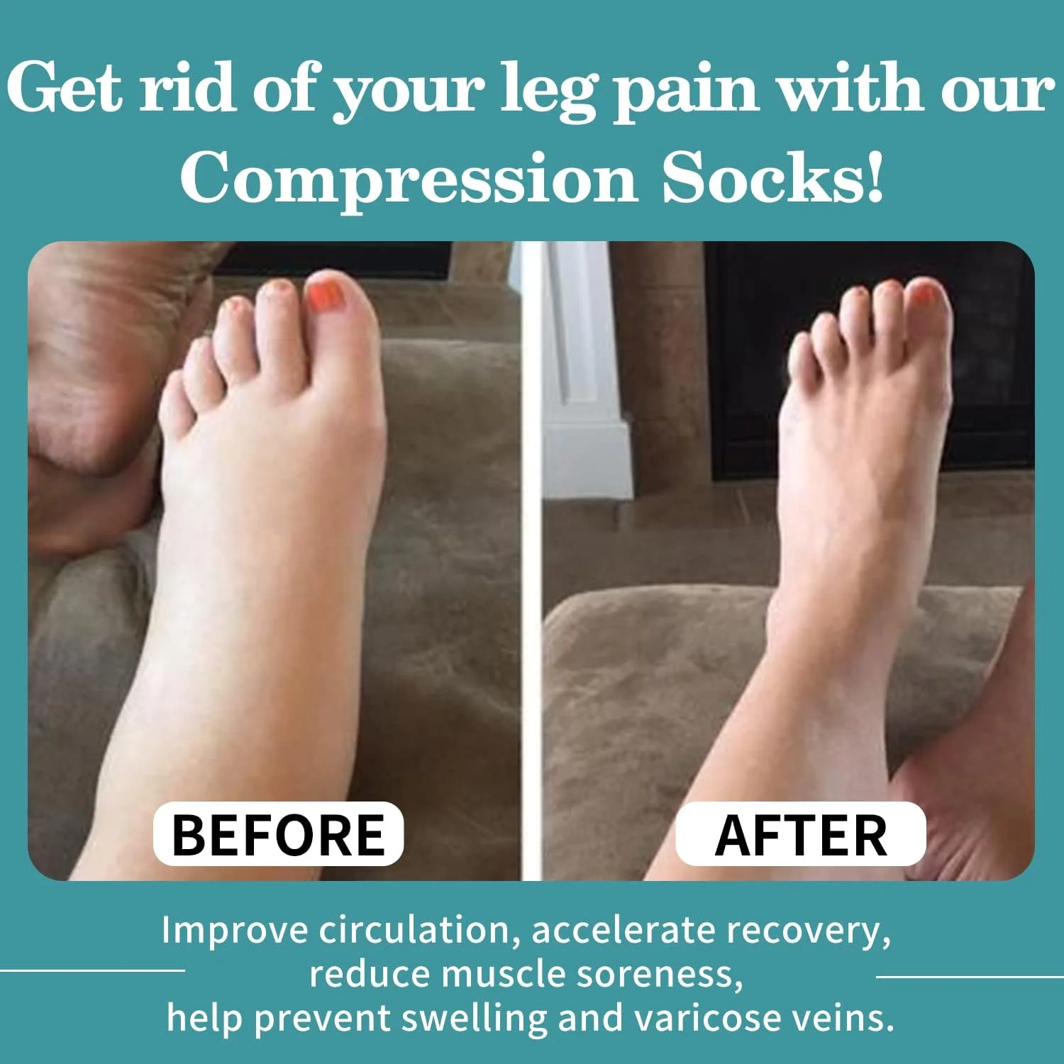 جوراب های فشاری برای گردش خون زنان و مردان - بهترین پشتیبانی برای دویدن، ورزش و دوران بارداری