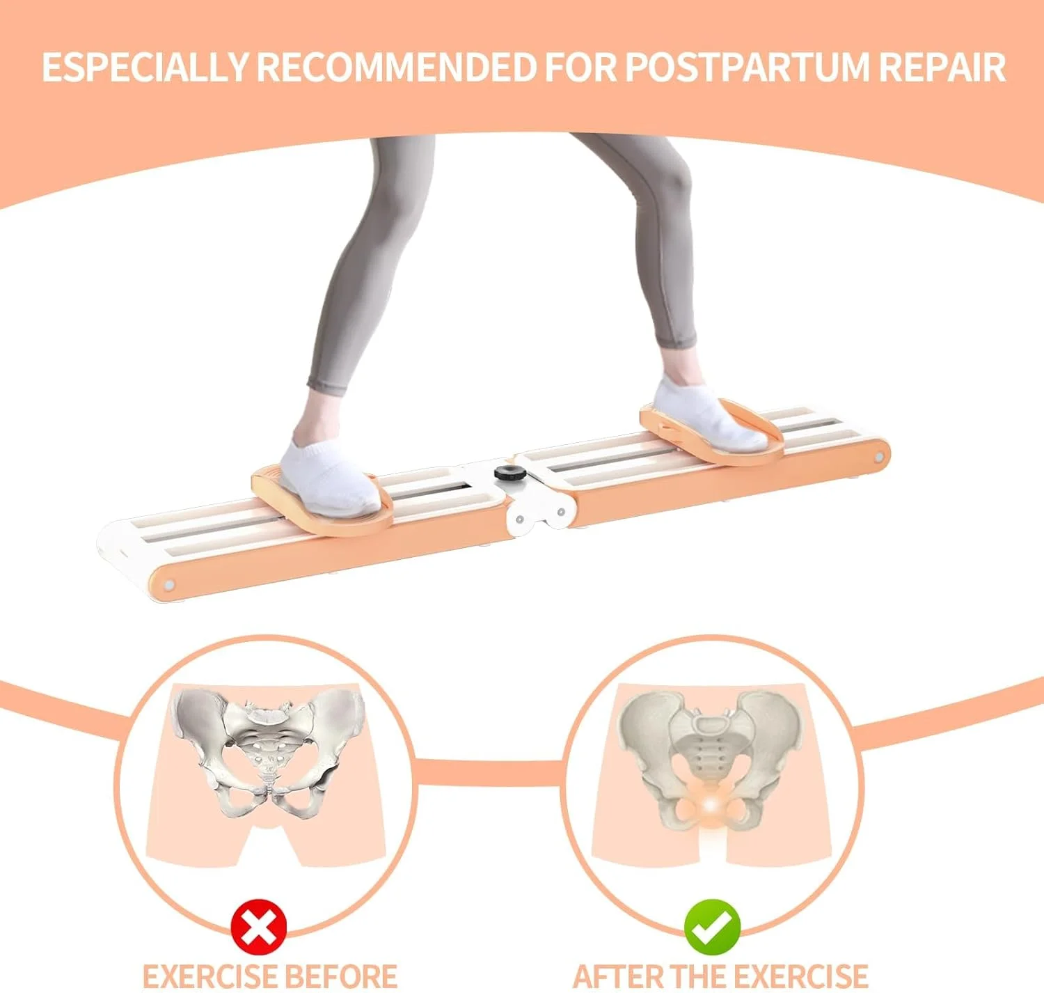 تقویت کننده عضلات ران NALACAL، تجهیزات تمرین لگن و داخل ران، تمرین دهنده عضلات کف لگن با کش مقاومتی برای پا، تقویت کننده ران، محصولات تمرین کگل برای زنان