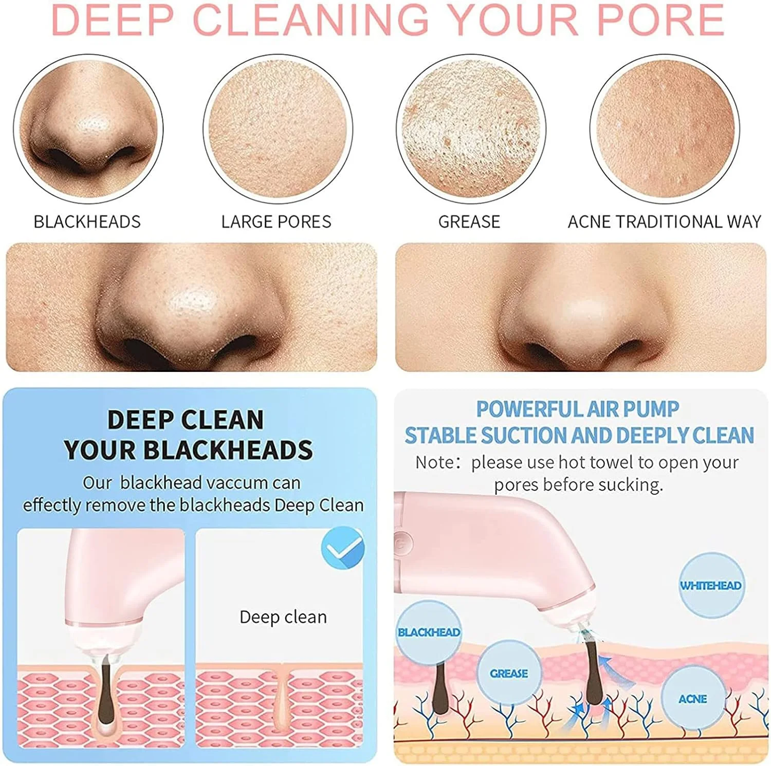 دستگاه پاک کننده منافذ برقی و جوش سرسیاه مناسب استفاده خانگی