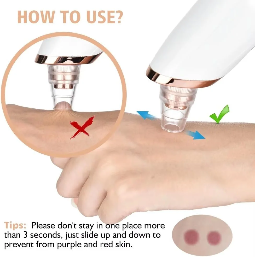 مجموعه حرفه ای پاک کننده جوش سرسیاه - دستگاه مکش منافذ با 5 سطح مکش، نور LED و 4 سری برای پاکسازی عمیق، لایه برداری و درمان آکنه - ابزار مراقبت از پوست بدون درد