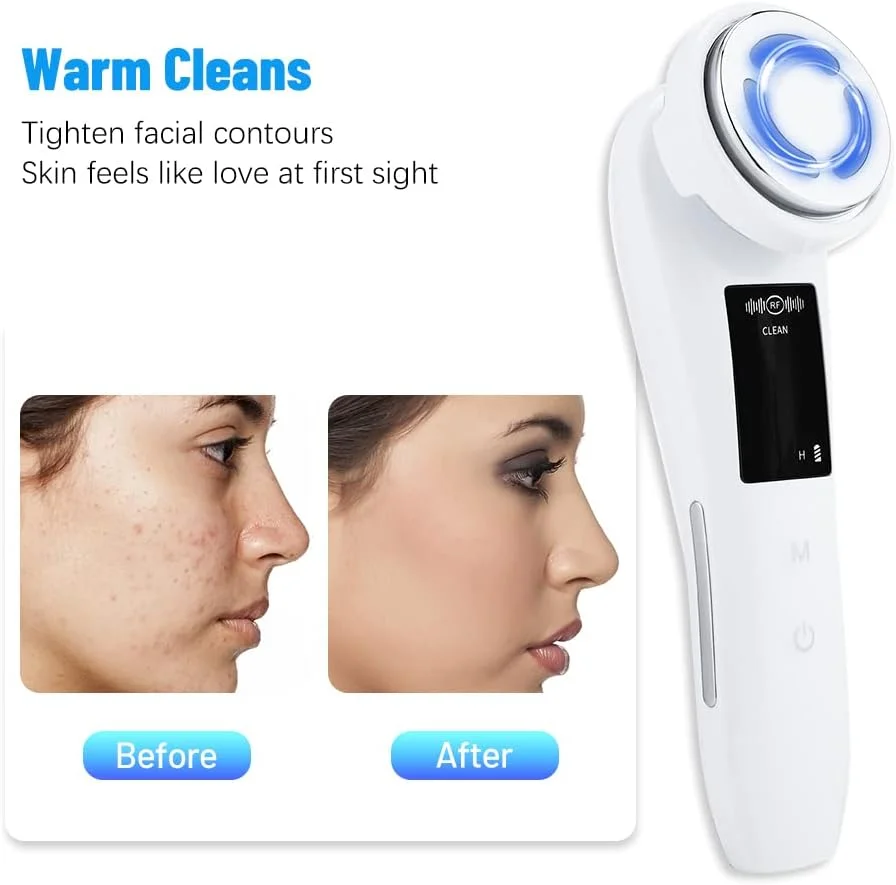 دستگاه 5 در 1 EMS برای لیفت صورت، جوانسازی پوست با میکرو جریان، ماساژور صورت با نور درمانی، ضد پیری و رفع چین و چروک، از بین برنده جوش های سرسیاه و آکنه با مکش خلاء