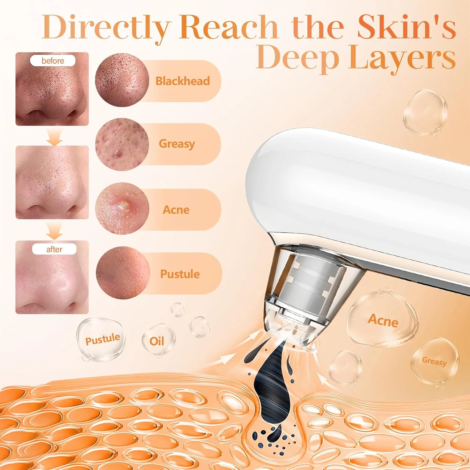 دستگاه پاک کننده جوش سرسیاه Yccu، دستگاه الکتریکی برای پاکسازی صورت و رفع منافذ، مکش جوش ها و آلودگی ها با 4 سری و 4 حالت مکش، دستگاه مکنده جوش سرسیاه دستگاه پاک کننده جوش سرسیاه Yccu، دستگاه الکتریکی برای پاکسازی صورت و رفع منافذ، مکش جوش ها و آلودگی ها با 4 سری و 4 حالت مکش، دستگاه مکنده جوش سرسیاه