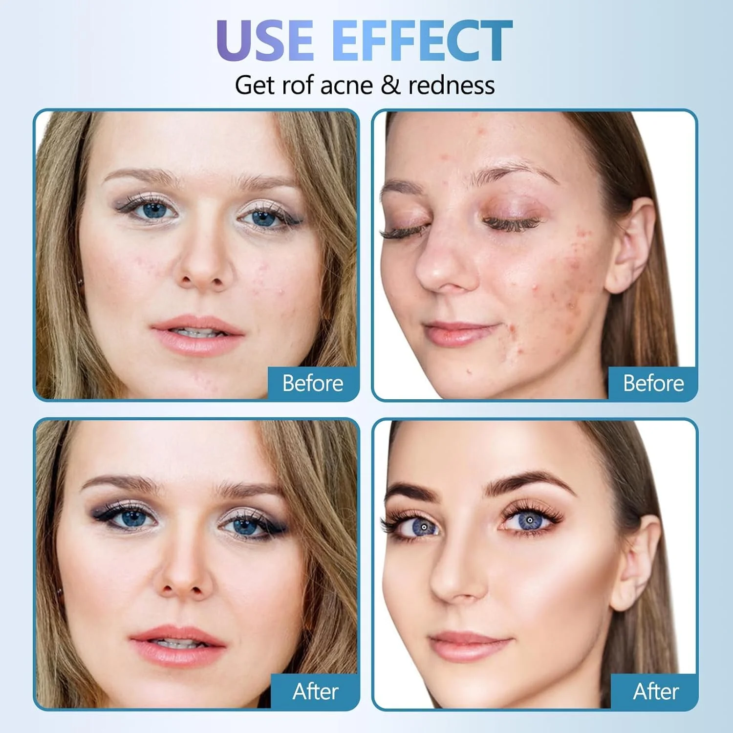 ۱۰ عدد ماسک صورت کره‌ای، ماسک کلاژن با اسید سالیسیلیک، ماسک ورقه‌ای صورت آبرسان و مرطوب کننده عمیق، تسکین دهنده و ترمیم کننده پوست برای پوستی شفاف و درخشان