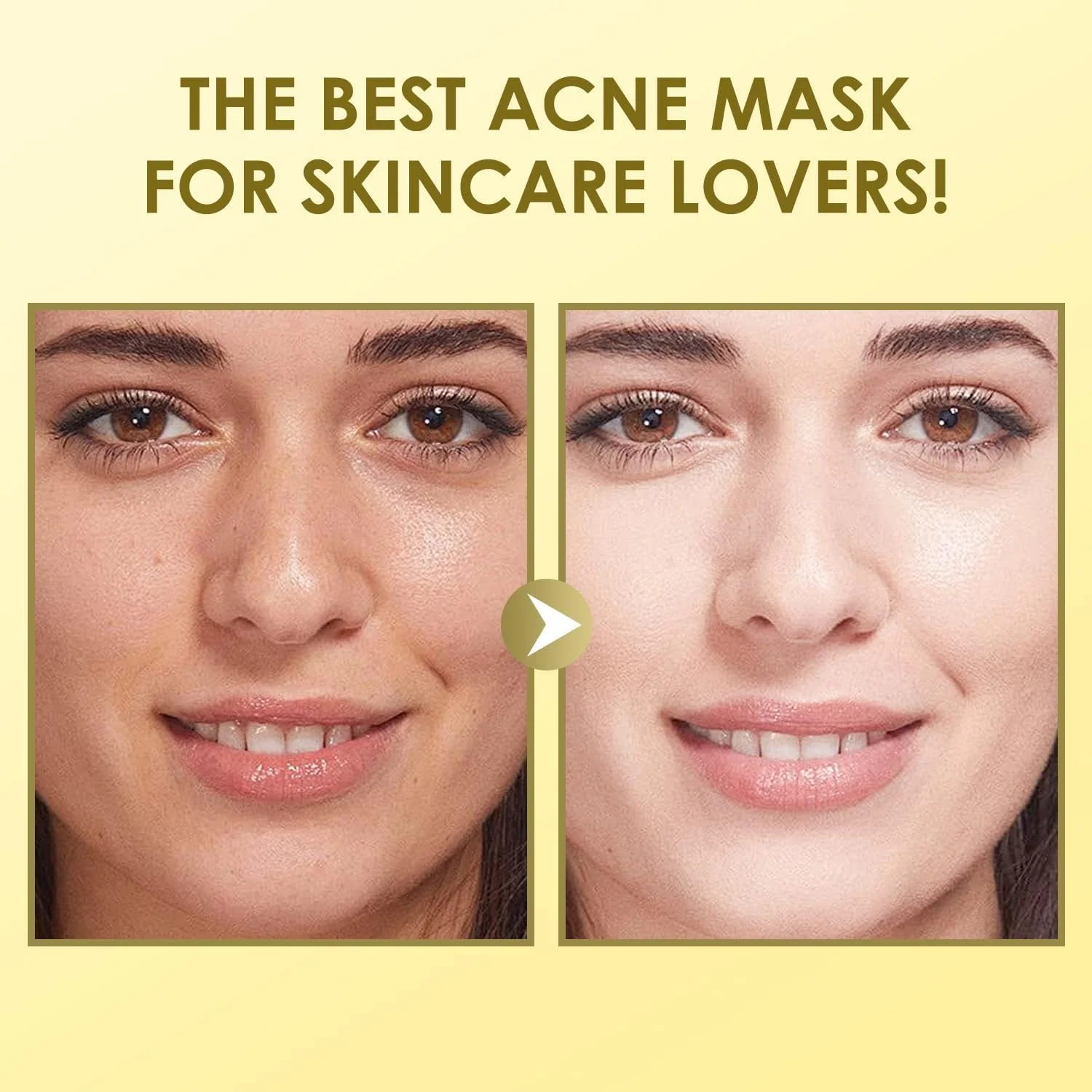 ۱۰ عدد ماسک صورت، ماسک ورقه ای موسین حلزون، سرم موسین حلزون، ماسک صورت آبرسان برای پوست خشک و حساس، مراقبت از خود، ماسک های ورقه ای، ماسک صورت برای مراقبت از پوست بانوان، هدیه ساقدوش عروس