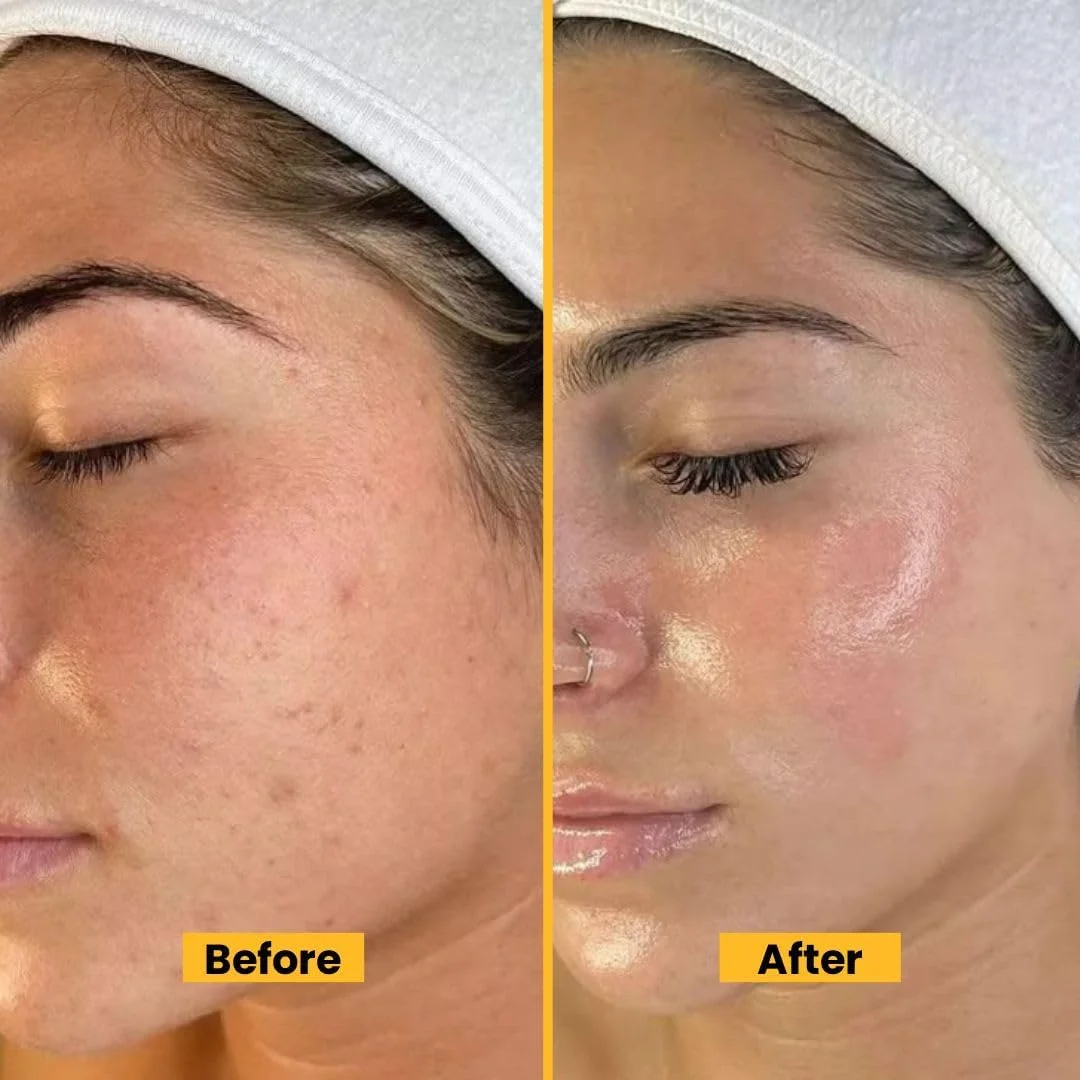 سرم روشن کننده ویتامین C بایوکاس (2 عددی) - سرم اصلاح کننده لک های تیره حاوی کلاژن، روغن جوجوبا و چای سبز - ضد پیری، آبرسان و روشن کننده - 15 میلی لیتر سرم روشن کننده ویتامین C بایوکاس (2 عددی) - سرم اصلاح کننده لک های تیره حاوی کلاژن، روغن جوجوبا و چای سبز - ضد پیری، آبرسان و روشن کننده - 15 میلی لیتر