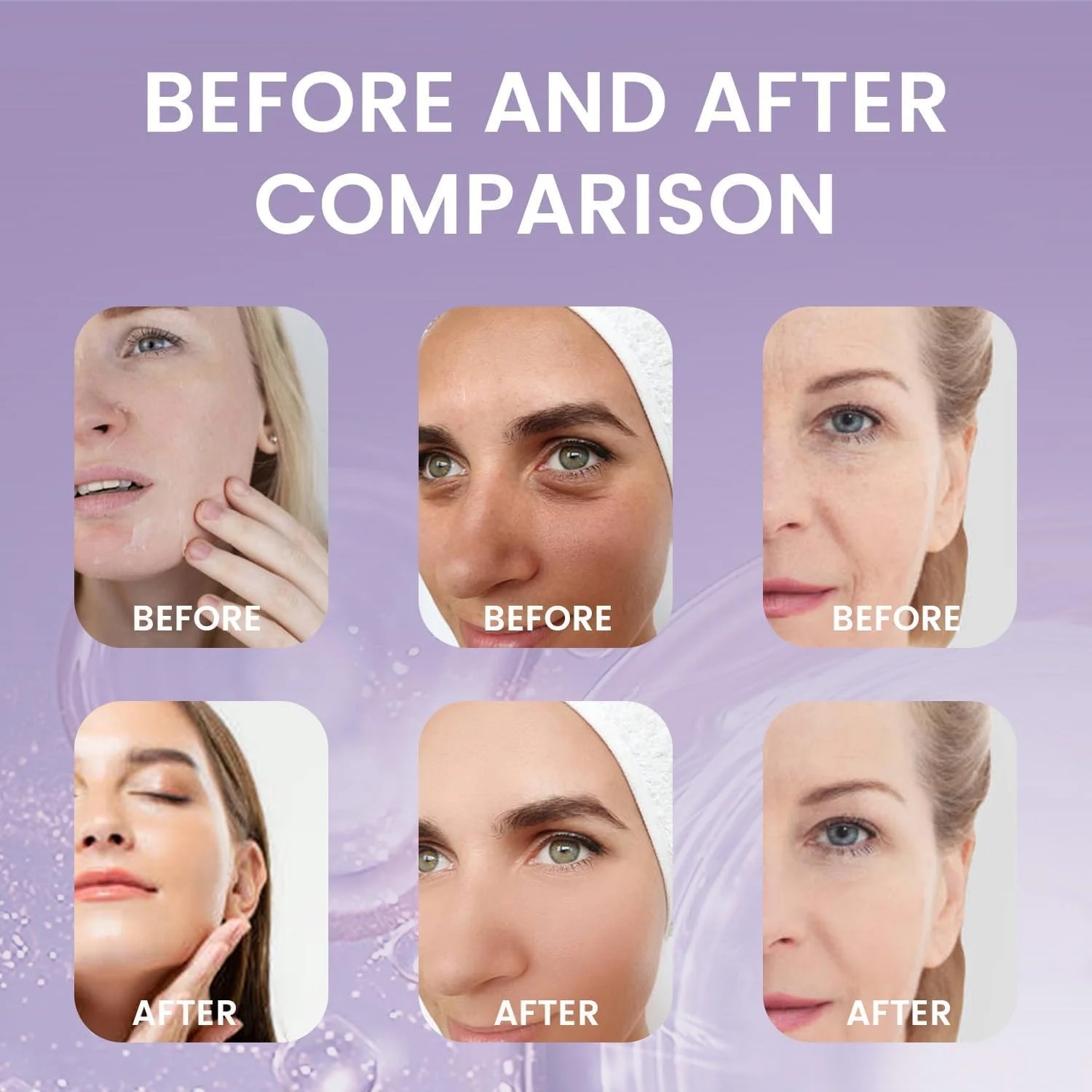 سرم ضد پیری باکوچیول و نیاسینامید آزونی، سرم آبرسان صورت با پپتیدها، صاف کننده خطوط ریز، چروک و منافذ، سفت کننده و روشن کننده پوست برای انواع پوست (30 میلی لیتر)