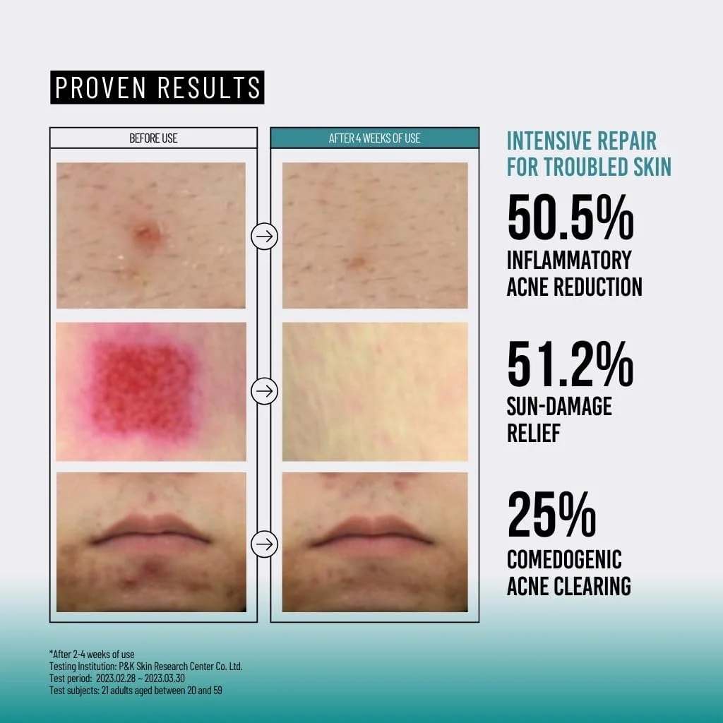 اسانس موسین حلزون ۹۵٪ + پپتید جومیسو ۱۴۰ میلی لیتر | سرم آبرسان حاوی حلزون، مرطوب کننده صورت برای پوست خشک، آبرسانی عمیق روزانه، مراقبت از پوست کره ای