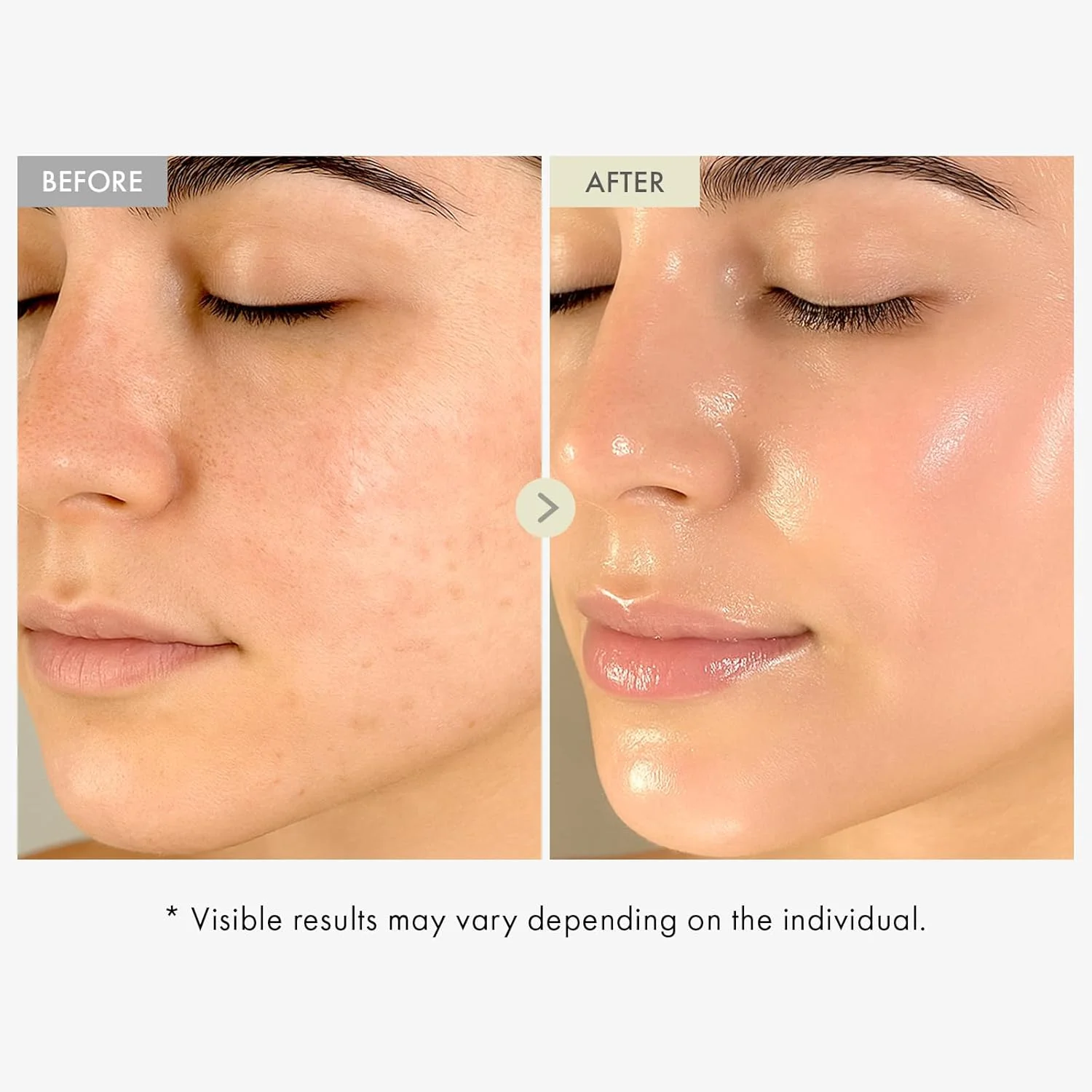 سرم صورت کلاژن توسوونگ، آبرسان و سفت کننده با کلاژن هیدرولیز شده و اسید هیالورونیک - پشتیبانی از خاصیت ارتجاعی و پوستی صاف - مراقبت از پوست کره ای، 33 میلی لیتر سرم صورت کلاژن توسوونگ، آبرسان و سفت کننده با کلاژن هیدرولیز شده و اسید هیالورونیک - پشتیبانی از خاصیت ارتجاعی و پوستی صاف - مراقبت از پوست کره ای، 33 میلی لیتر