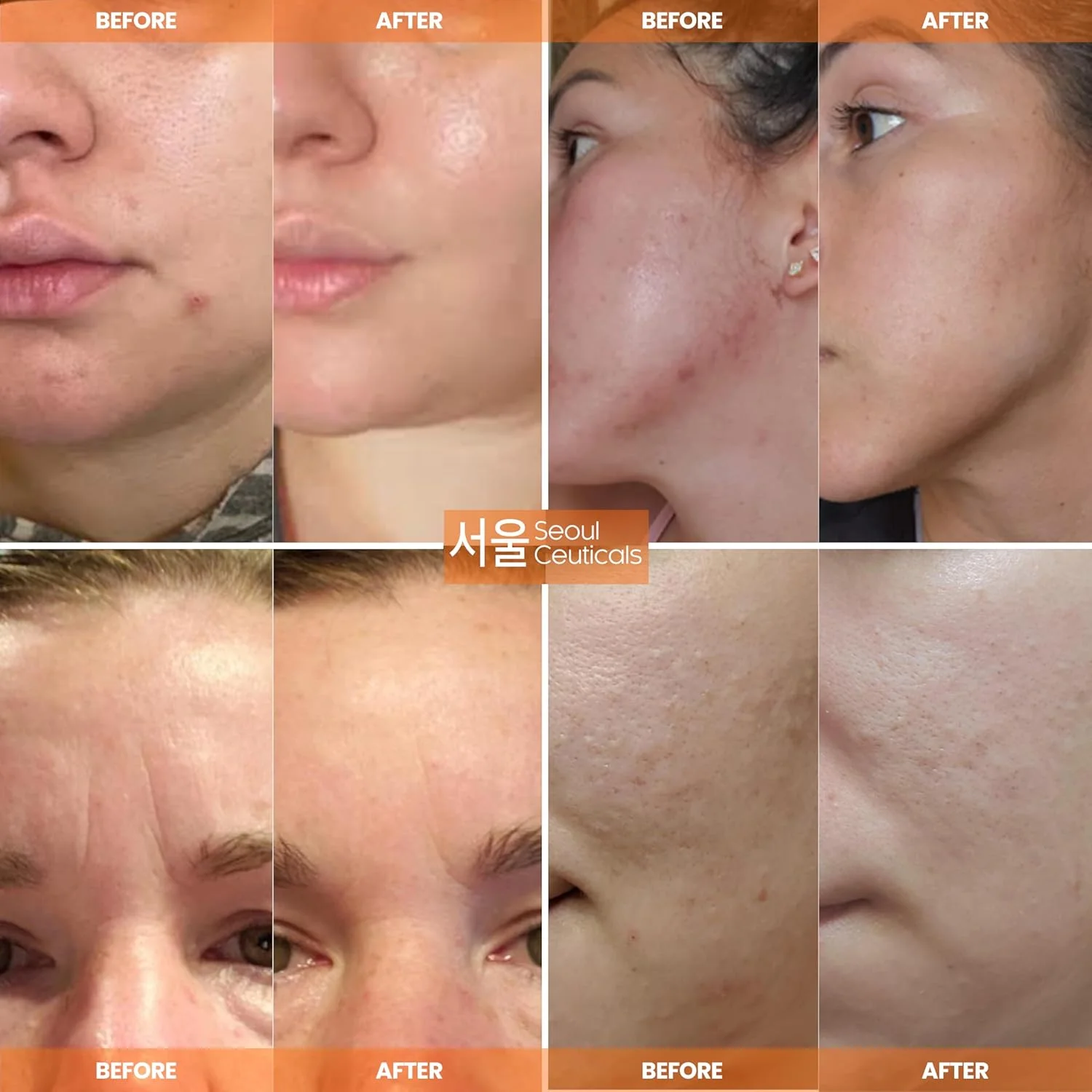 کرم ترمیم کننده حلزون مراقبت از پوست کره‌ای سئول سوتیکالز - 97.5% عصاره موسین حلزون - قدرت ترمیم کننده همه جانبه برای موثرترین روتین زیبایی کره‌ای - 2oz