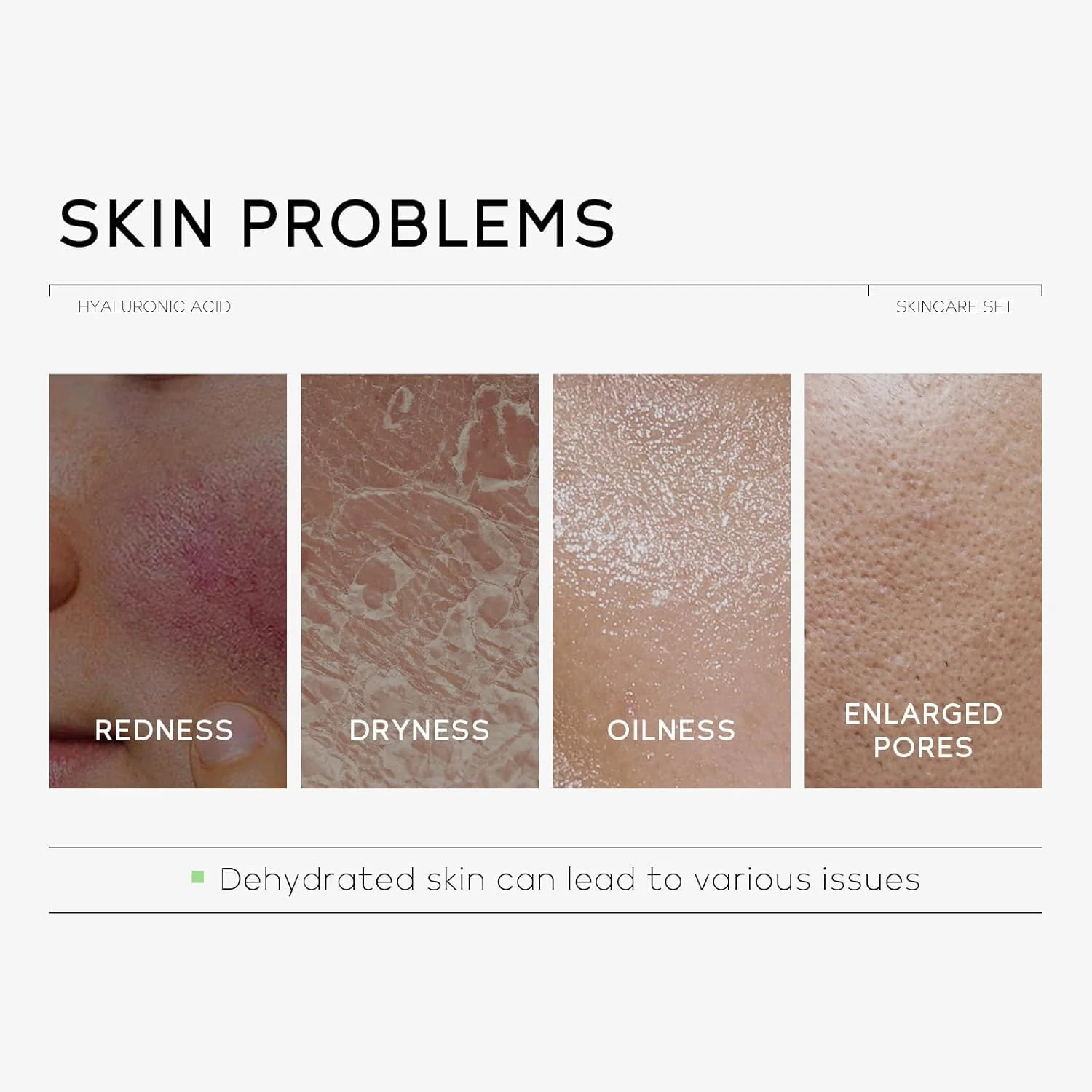 مجموعه مراقبت از پوست حاوی اسید هیالورونیک، مجموعه مرطوب کننده پوست دخترانه، مجموعه مسافرتی مراقبت از پوست حاوی اسید هیالورونیک، کرم صورت، کرم دور چشم، ضد پیری، سفت کننده، مرطوب کننده عمیق، مناسب برای پوست های خشک و حساس