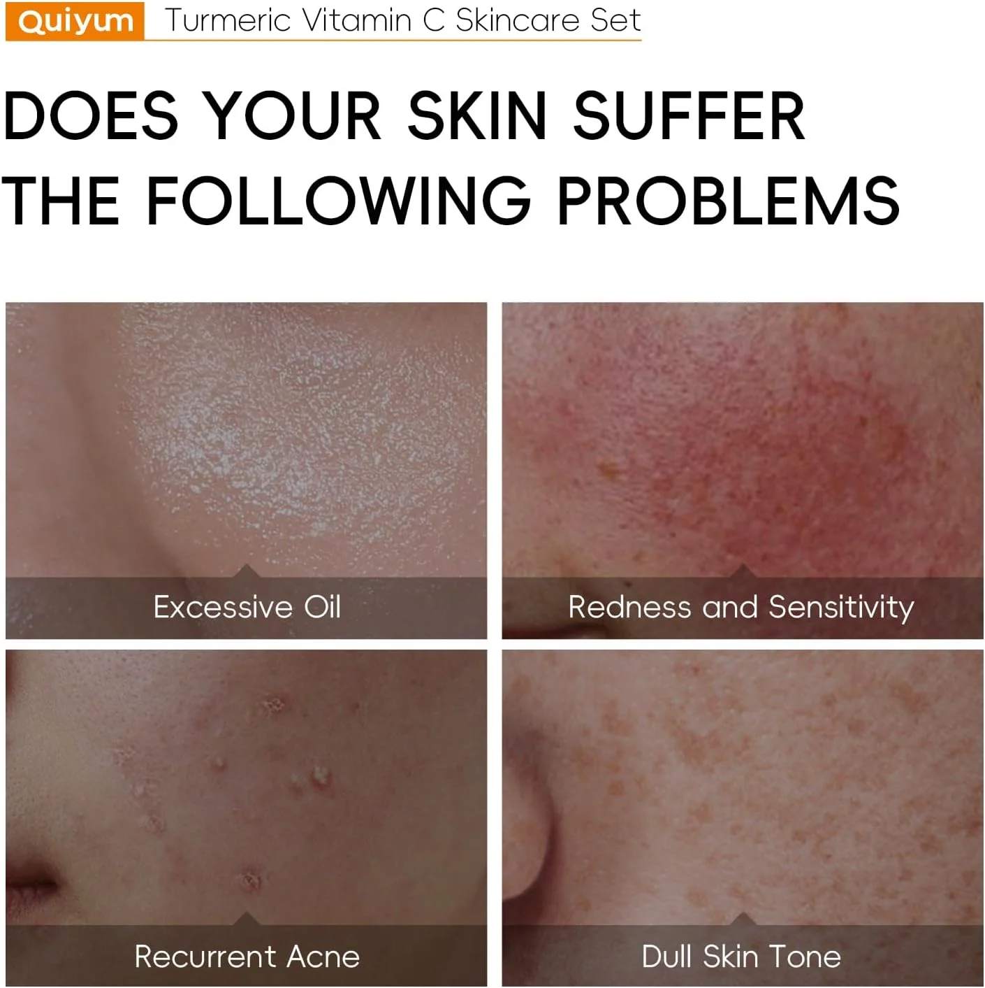 مجموعه مراقبت از پوست صورت لایکو با عصاره زردچوبه و ویتامین C، شامل 5 محصول، مناسب برای مسافرت، شامل: شوینده صورت، تونر، کرم دور چشم آبرسان، سرم و کرم صورت