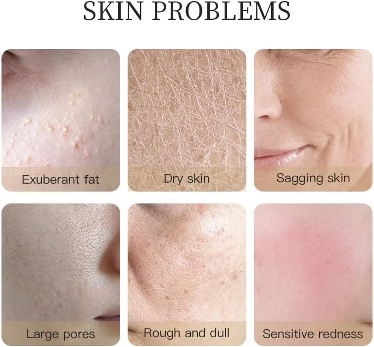 مجموعه مراقبت از پوست حاوی طلای 24 عیار - شیر اسانس، شستشوی صورت، تونر، سرم سفت کننده، کرم احیا کننده صورت، مراقبت جامع برای انواع پوست های خشک، چرب، افتاده، دارای منافذ باز، کدر و حساس