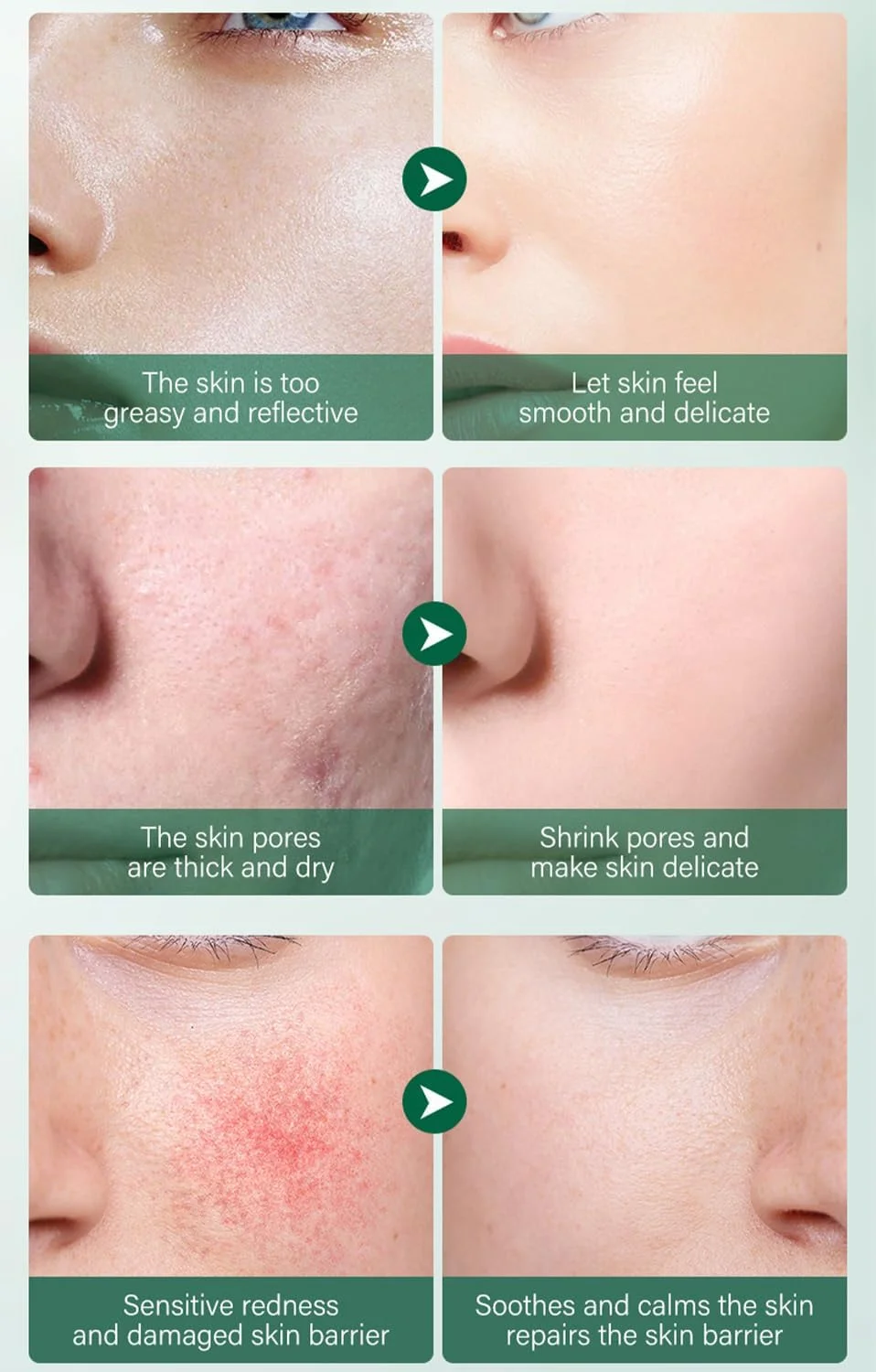 مجموعه مراقبت کامل صورت سنتلا آسیاتیکا، ست هدیه مراقبت از پوست 5 در 1 شامل پاک کننده، سرم صورت، کرم صورت، تونر، امولسیون آب، ضد پیری، تقویت کننده کلاژن و آبرسان برای بانوان