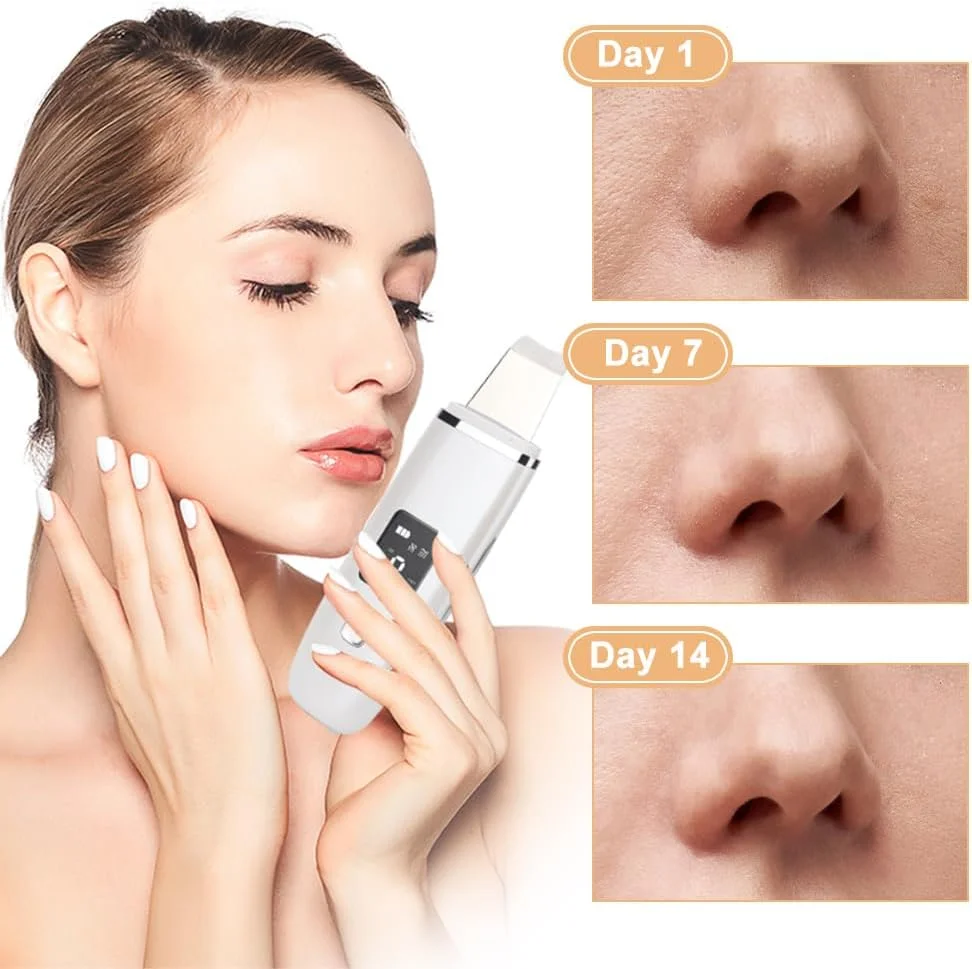 پکیج هدیه دستگاه مراقبت از صورت اولتراسونیک برقی، اسکرابر پوست، تخلیه کننده جوش سرسیاه، ابزار زیبایی پاک کننده صورت، برس پاک کننده سیلیکونی