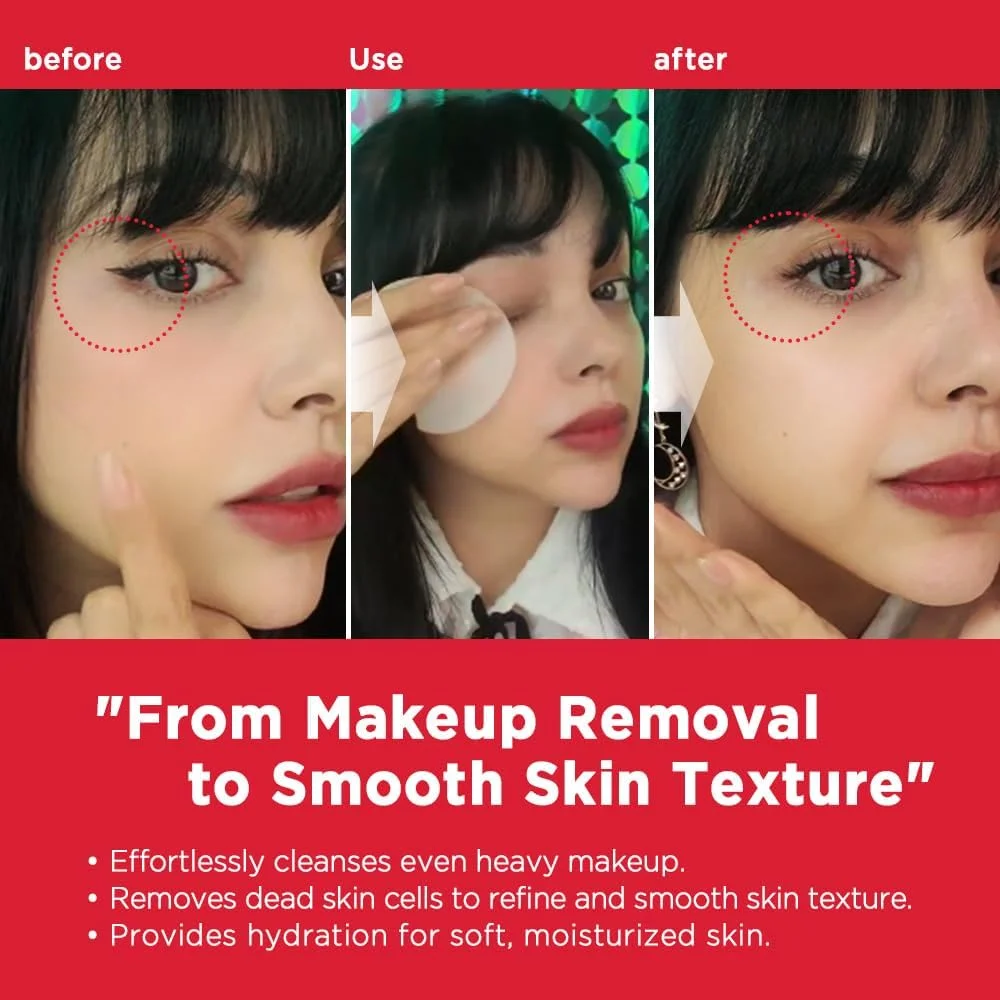 پدهای پاک کننده ملایم روزانه نایتینگل درما، 70 عدد - مراقبت از پوست صورت کره ای با اسید هیالورونیک، پاک کننده آرایش آبرسان - پدهای لایه بردار ملایم صورت