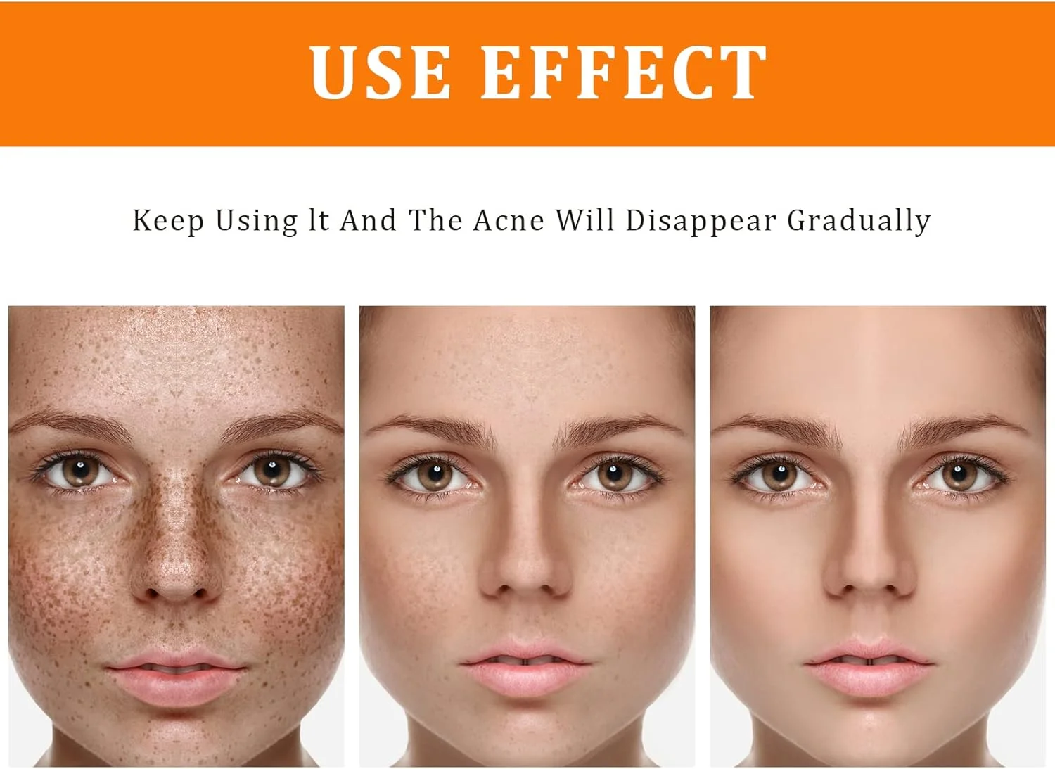 تونر اصلاح کننده لکه‌های تیره زردچوبه، تونر صورت برای پوست مستعد آکنه، از بین برنده لکه‌های تیره صورت، تونر آبرسان صورت برای زنان، تونر مرطوب کننده صورت برای پوست خشک و چرب - 120 میلی لیتر