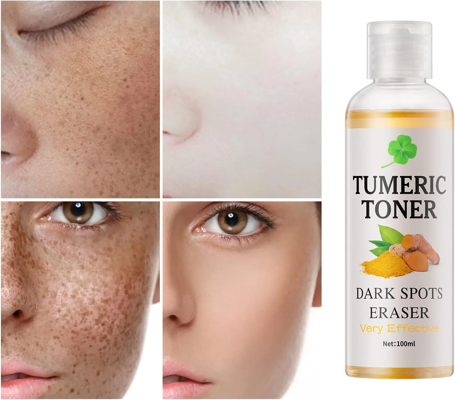 تونر اصلاح کننده لکه‌های تیره زردچوبه، تونر صورت برای پوست مستعد آکنه، از بین برنده لکه‌های تیره صورت، تونر آبرسان صورت برای زنان، تونر مرطوب کننده صورت برای پوست خشک و چرب - 120 میلی لیتر