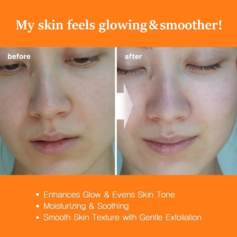 تونر پاک کننده ملایم و شفاف کننده پوست نایتینگل مدل C-Toning، 200 میلی لیتر - مرطوب کننده و تغذیه کننده پوست حاوی اسانس، AHA، BHA، PHA و ویتامین C - تونر لایه بردار با مواد طبیعی