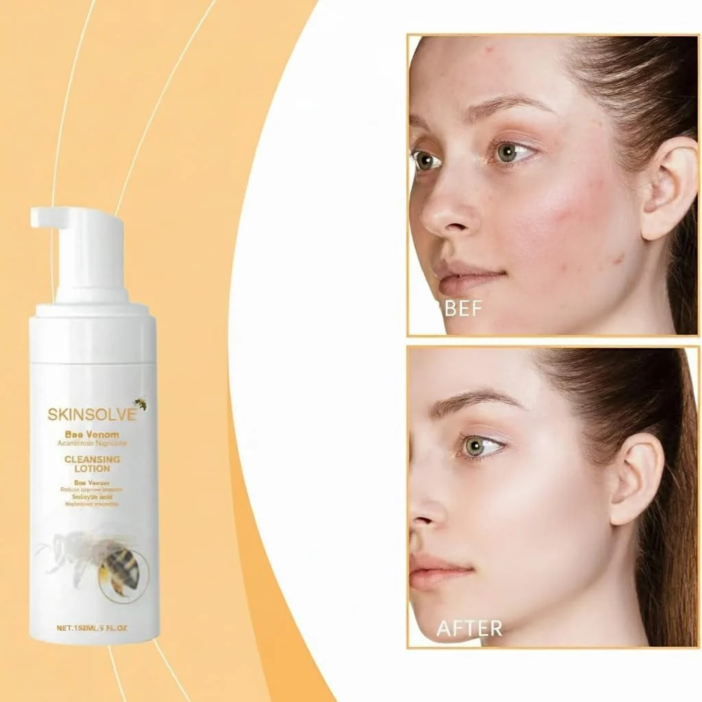 فوم شستشوی صورت کرم زنبور عسل، پاک کننده ملایم صورت کرم زنبور عسل، شستشوی عمیق و روشن کننده صورت برای پوست مستعد جوش، پاک کننده ملایم صورت زنبور عسل برای باز کردن منافذ، جای جوش و لکه های تیره برای انواع پوست