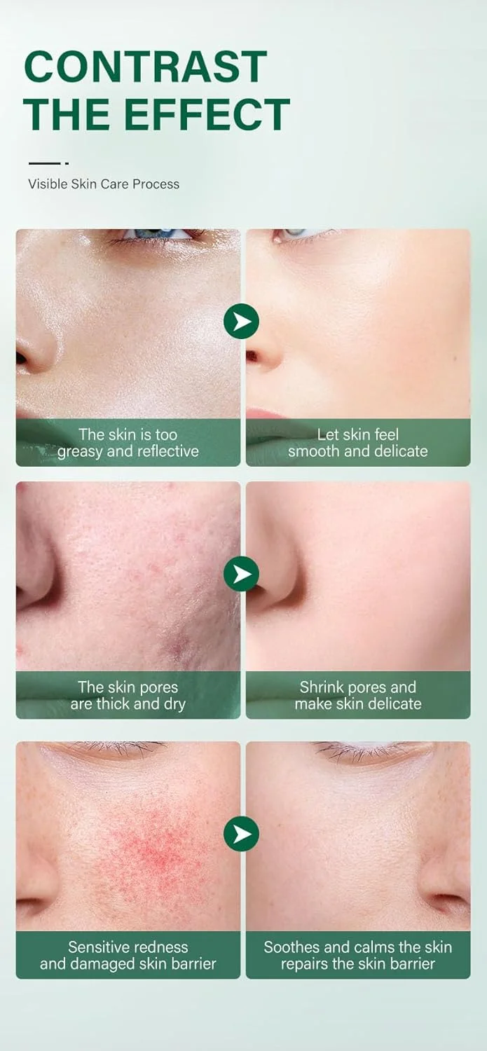 لوسیون پاک کننده صورت سنتلا، پاک کننده و مرطوب کننده پوست، پاکسازی ملایم و کوچک کننده منافذ، مناسب برای انواع پوست