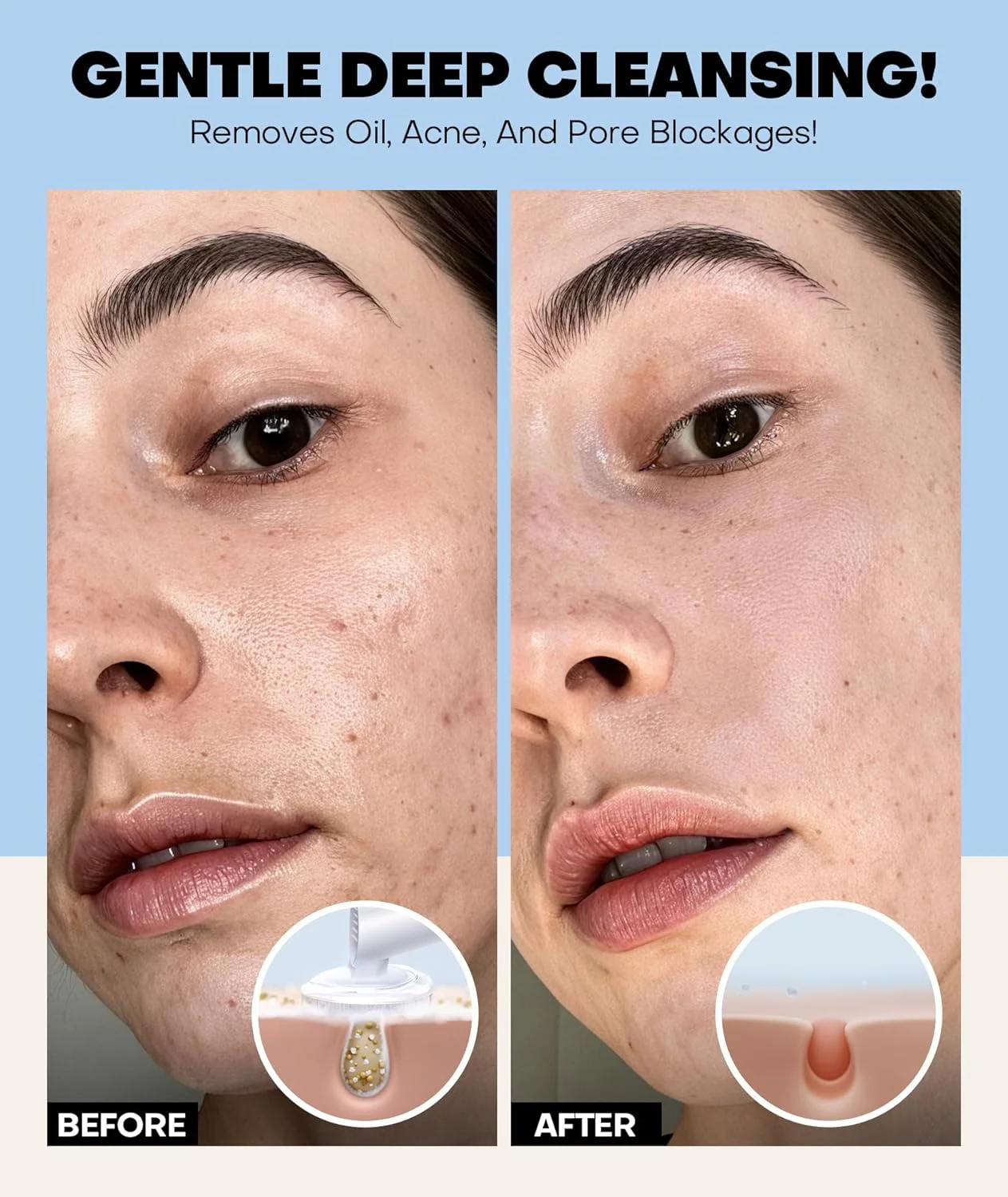 فوم شستشوی صورت بسیار ملایم، پاک کننده عمیق صورت با برس، مرطوب کننده و غیر تحریک کننده برای پوست های حساس، خشک و انواع پوست، کنترل کننده چربی و پاک کننده منافذ پوست برای طراوت (آبی)