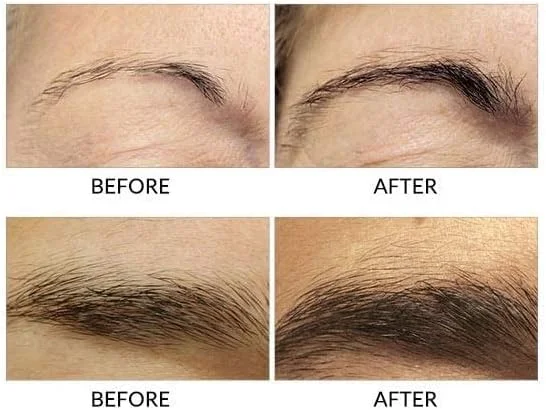 سرم تقویت کننده ابرو رپیدبرو، شفاف، 3 میلی لیتر