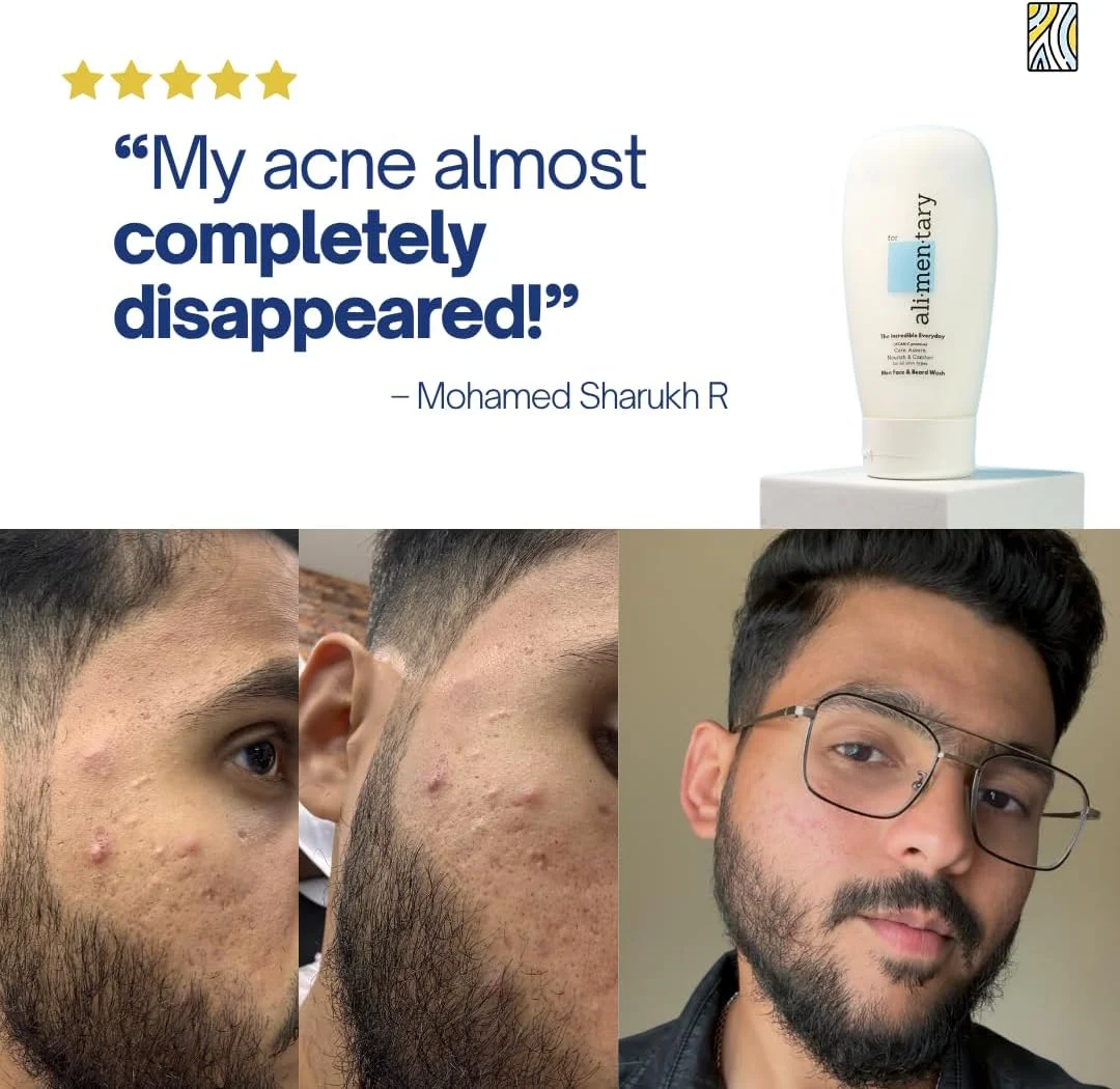 شوینده صورت و ریش مردانه - پاک کننده ملایم، بدون ایجاد خشکی | تسکین دهنده شوره ریش | آبرسان و ضد خارش | شستشوی صورت | فرمولاسیون 94% طبیعی | مناسب برای انواع پوست | 150 میلی لیتر