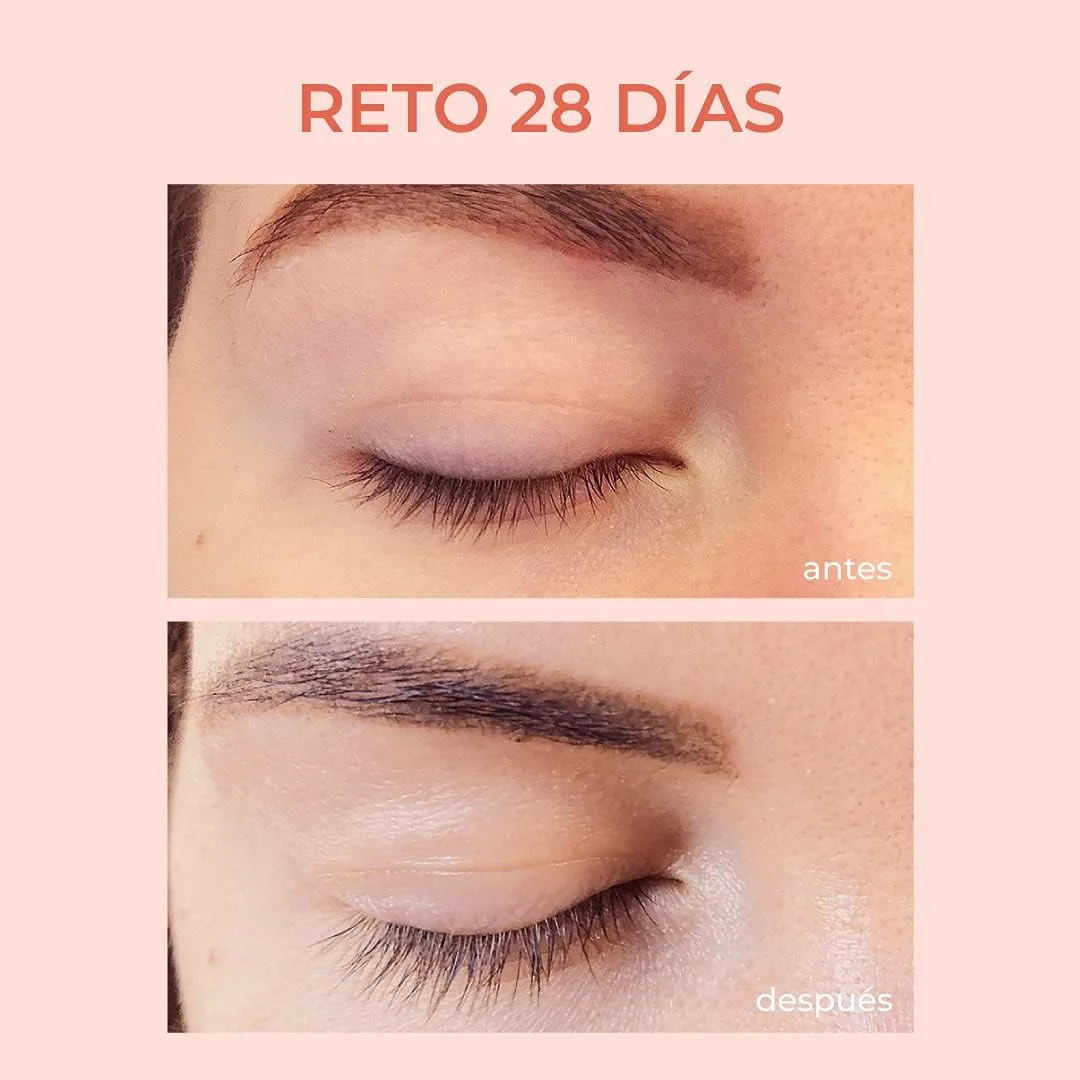 سرم تقویت مژه Xlash Pro حجم 6 میلی لیتر، بهترین سرم طبیعی برای مژه‌های بلندتر