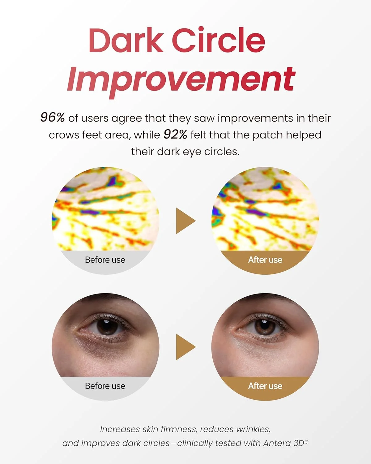 پچ دور چشم انرژی غذای قرمز YADAH