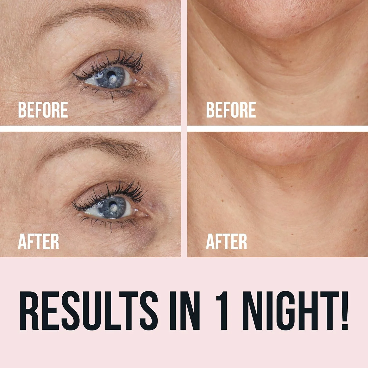 پدهای سیلیکونی رفع چروک صورت SiO Beauty - پدهای ضد چروک برای گردن، پیشانی، چشم و خط خنده، پدهای صاف کننده سیلیکونی برای خطوط ریز و چروک در طول شب