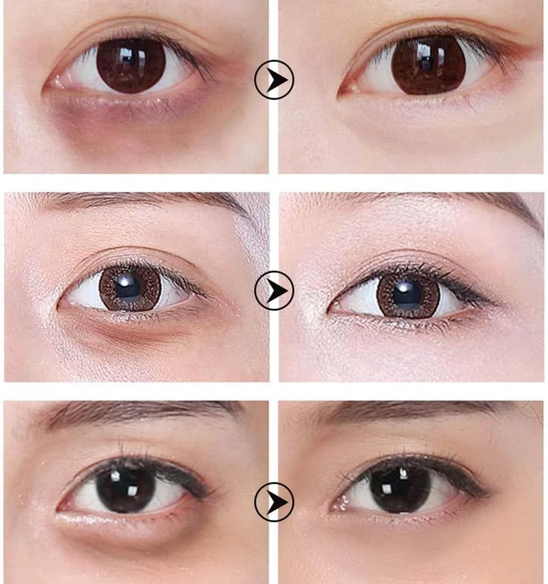 پچ دور چشم رتینول لانبنا، ضد چروک، کاهش تیرگی و روشن کننده پوست زیر چشم، محو کننده پف