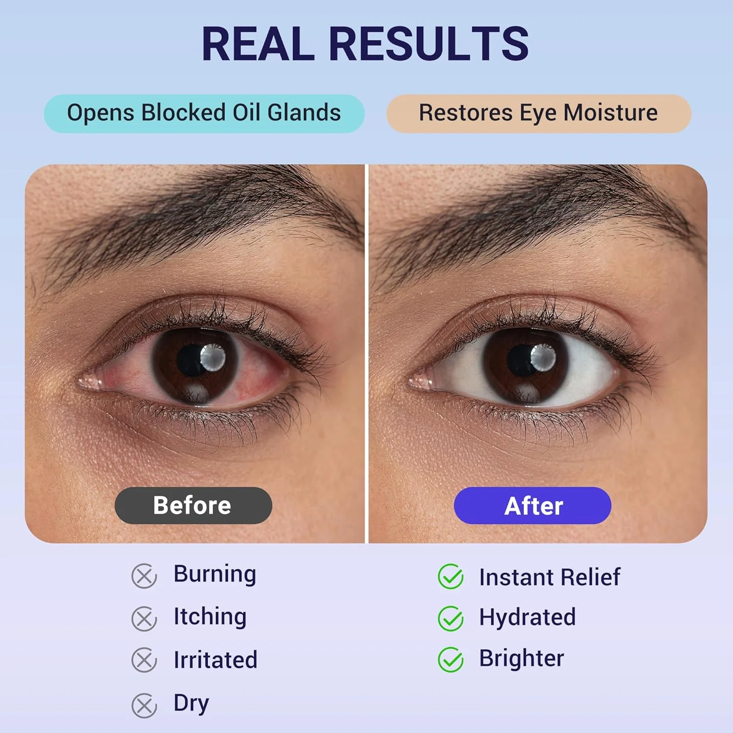 ماسک چشم بخار خود گرم شونده: کمپرس گرم چشم برای خشکی چشم، درمان گل مژه - 10 عدد ماسک خواب مرطوب یکبار مصرف برای رفع خستگی چشم و تسکین سردرد - ایده آل برای مسافرت و هدیه اسپا (بدون عطر)