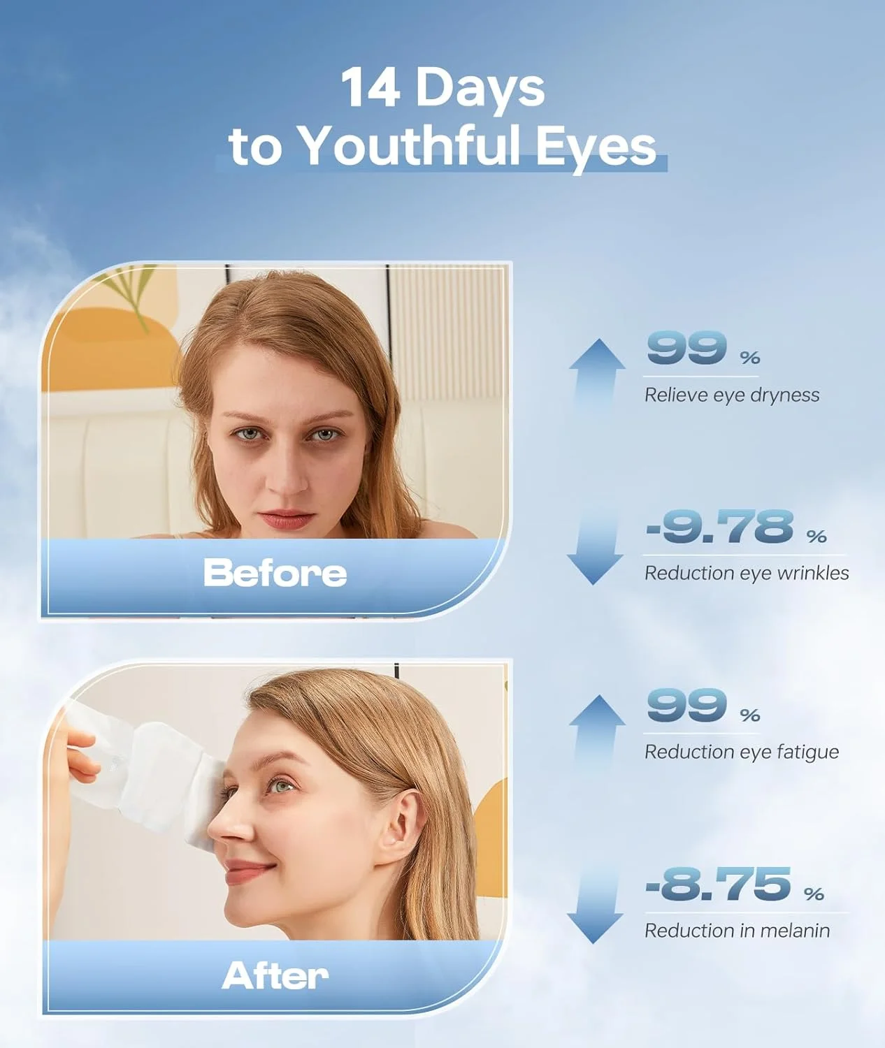 کمپرس گرم خود گرم شونده اسید هیالورونیک برای چشم، ماسک چشم گرم برای تسکین سریع خشکی چشم، 14 عددی ماسک چشم بخار، ماسک چشم بخار مرطوب کننده و بسیار موثر