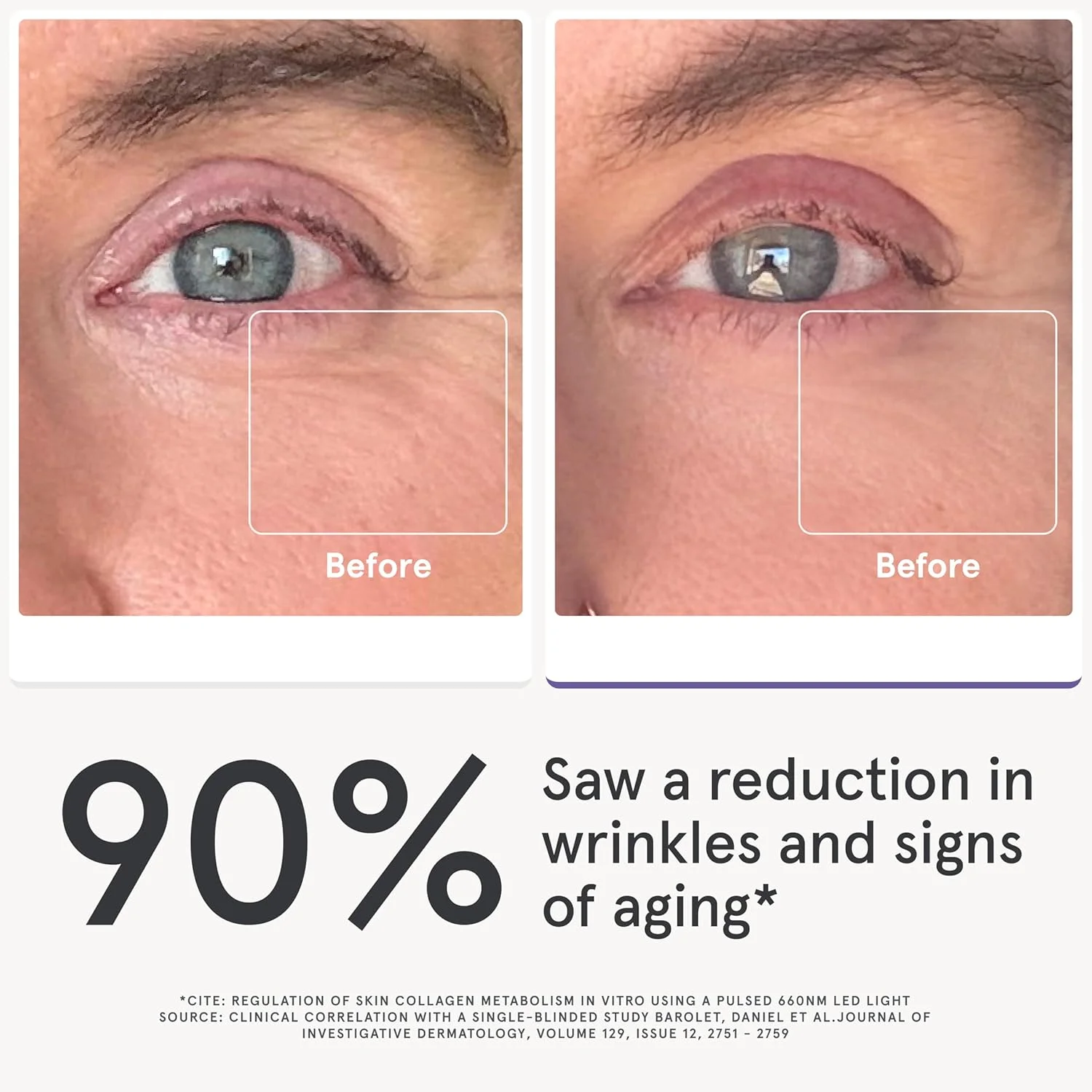 ماسک چشم LED iRestore Illumina با نور قرمز - ماسک چشم 180 LED با نور مادون قرمز برای چین و چروک زیر چشم، خطوط پیشانی، خط اخم، خطوط پنجه کلاغی، حلقه های تیره