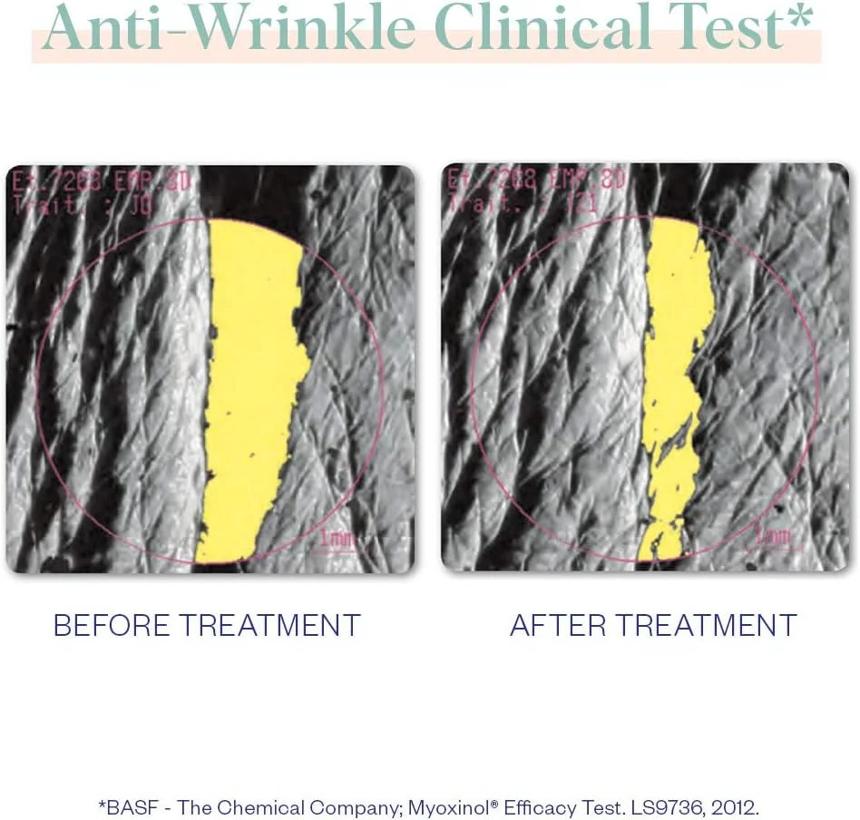 ماسک های صاف کننده و ضد پف دور چشم Wrinkles Schminkles - ماسک ضد پف کلاژن برای صاف کردن چروک ها، کاهش پف زیر چشم و آبرسانی تیرگی های دور چشم - 100% زیست تخریب پذیر (5 جفت)