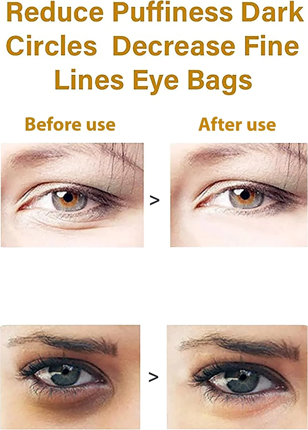 ماسک درمان دور چشم طلا، پدهای زیر چشم - درمان سیاهی دور چشم، درمان پف زیر چشم، ماسک کلاژن دور چشم برای پف چشم، ضد چروک - پیری، سیاهی دور چشم، بسته 1 جفتی