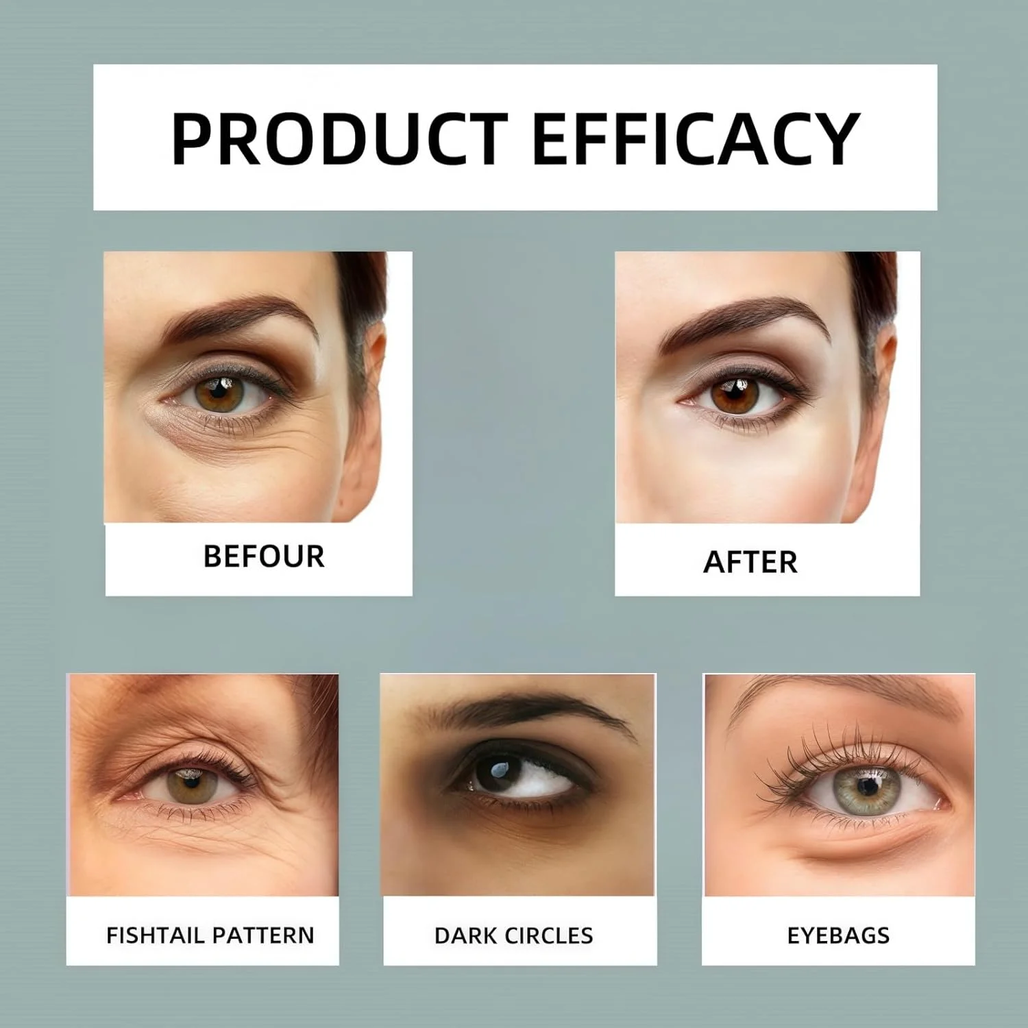 پچ های حل شونده دور چشم، ماسک دور چشم، پچ های دور چشم برای حلقه های تیره، پچ های ژلی زیر چشم، پچ های خنک کننده دور چشم، حاوی هیالورونیک اسید و پپتیدها، کاهش دهنده چین و چروک و پف