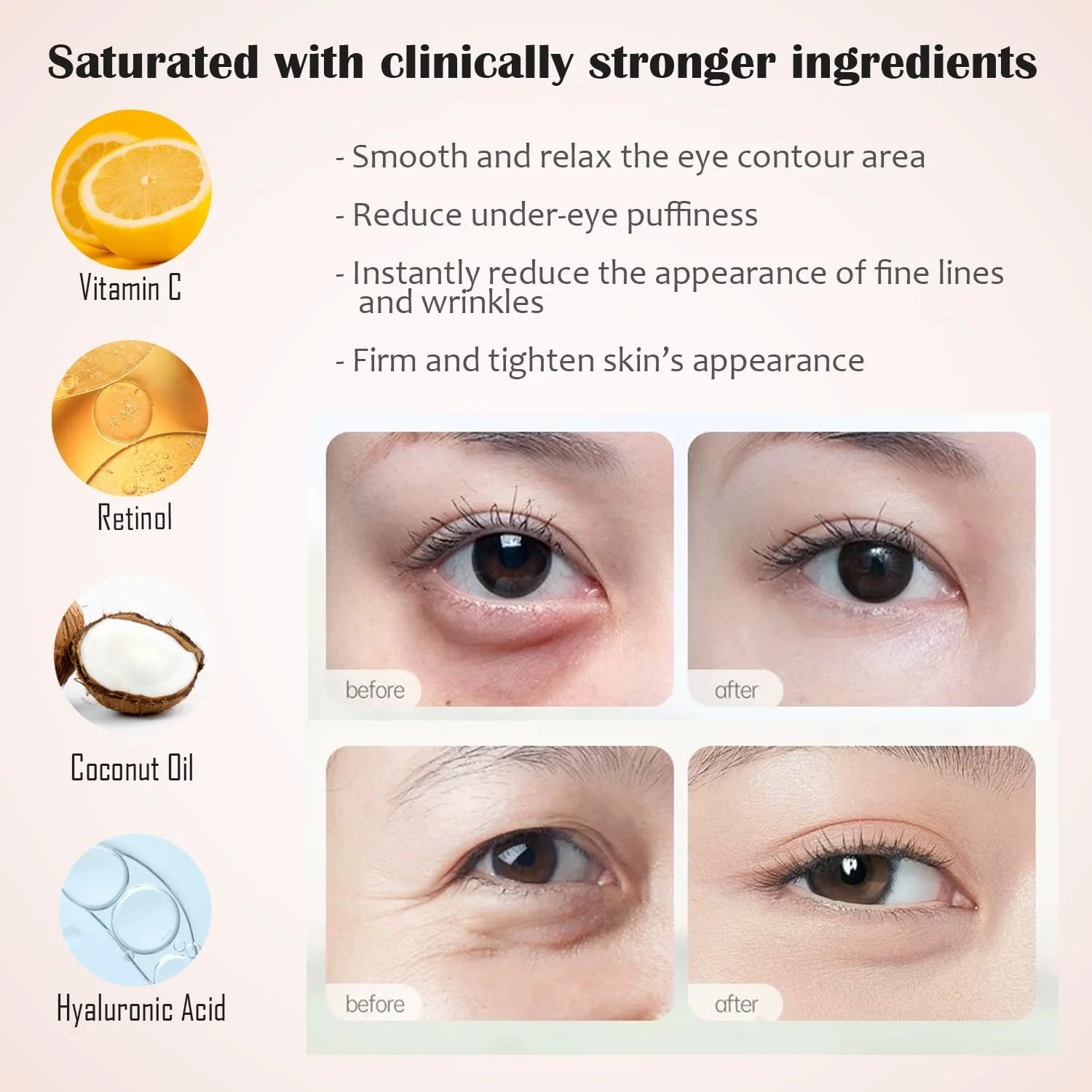 پدهای زیر چشم، 30 جفت ماسک چشم برای سیاهی دور چشم، پف، کیسه های زیر چشم، چین و چروک، پدهای ماسک چشم هیدروژل با طلای 24K، اسید هیالورونیک آبی، گل رز صورتی