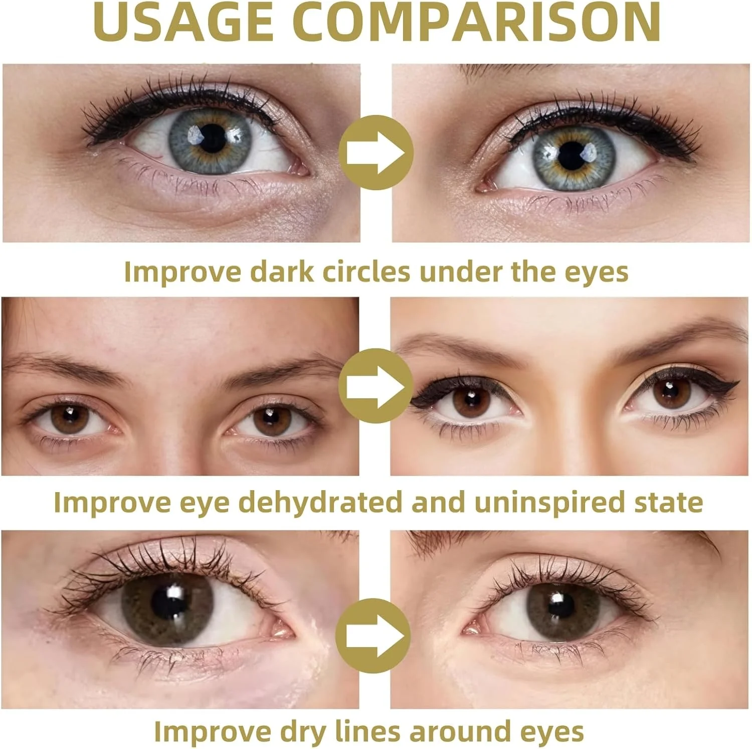 پد های زیر چشم سوزنی حل شونده، پد ضد چروک، پد های سوزنی برای سیاهی و پف زیر چشم، پد ژلی زیر چشم، پد آبرسان چشم، پد ژل آبی چشم، پد ژلی خنک کننده چشم