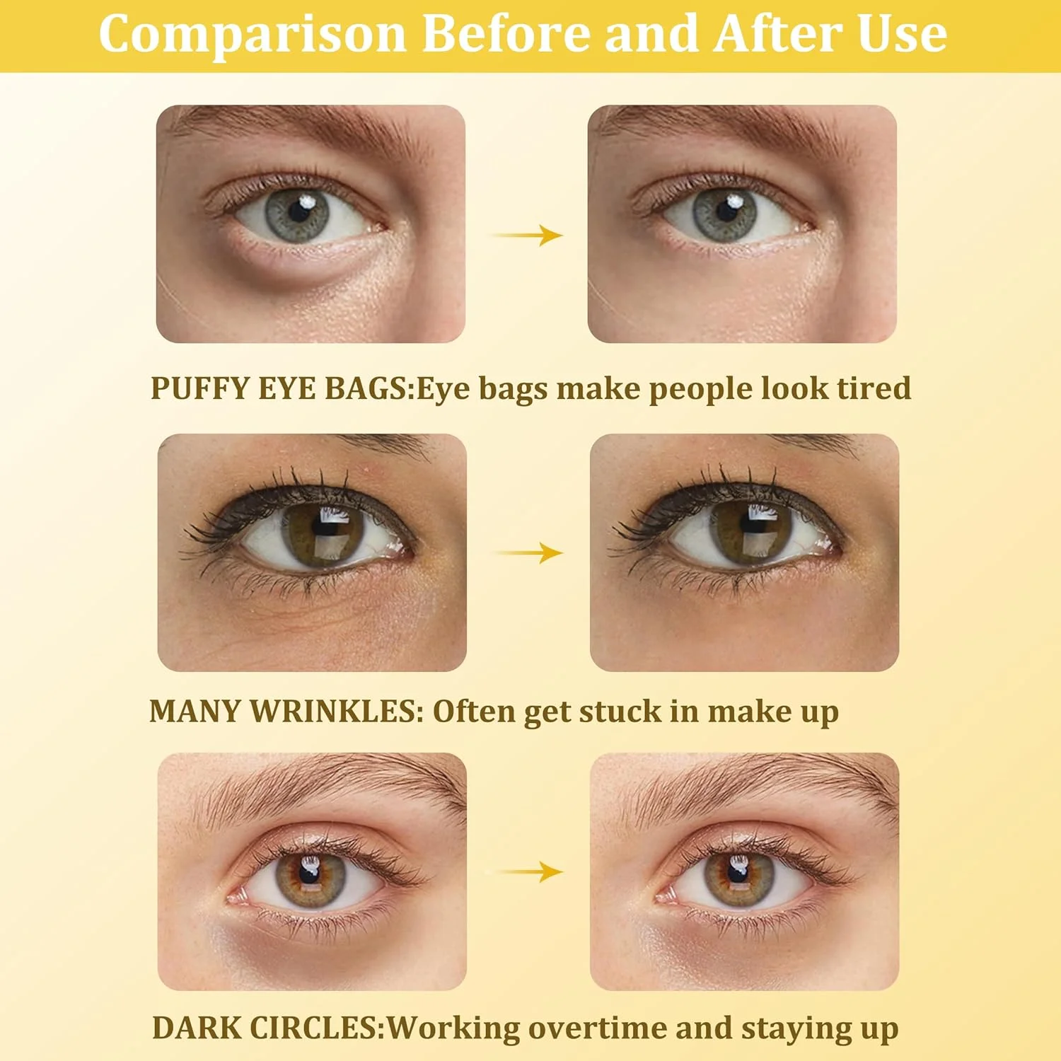 پد زیر چشم، ماسک زیر چشم کلاژن، درمان سیاهی دور چشم، رفع پف و کیسه های زیر چشم، ضد پیری، کاهش چین و چروک، مراقبت از پوست، آبرسان - 30 جفت (طلای 24 عیار)