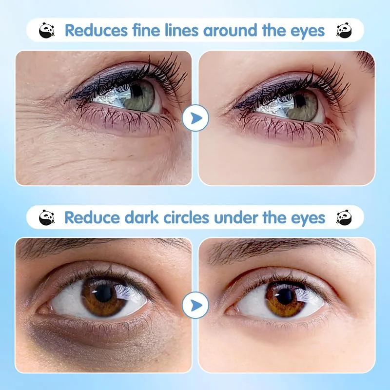 پچ های آبرسان زیر چشم برای سیاهی و پف زیر چشم - 60 جفت ماسک چشم با اسید هیالورونیک، بلوبری و سنتلا - وگان، مراقبت از پوست بدون تست حیوانی