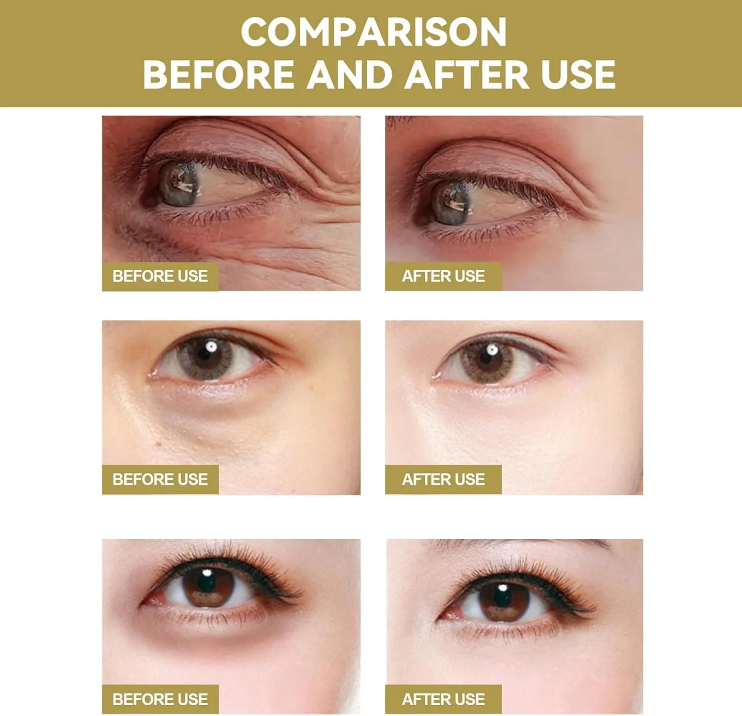 پچ های سوزنی ریز ضد چروک 3 عددی، پچ های سوزنی ریز حل شونده دور چشم، پچ های ضد چروک، پچ های زیر چشم، درمان سیاهی و پف زیر چشم، ماسک زیر چشم، پچ های سوزنی ریز برای بانوان