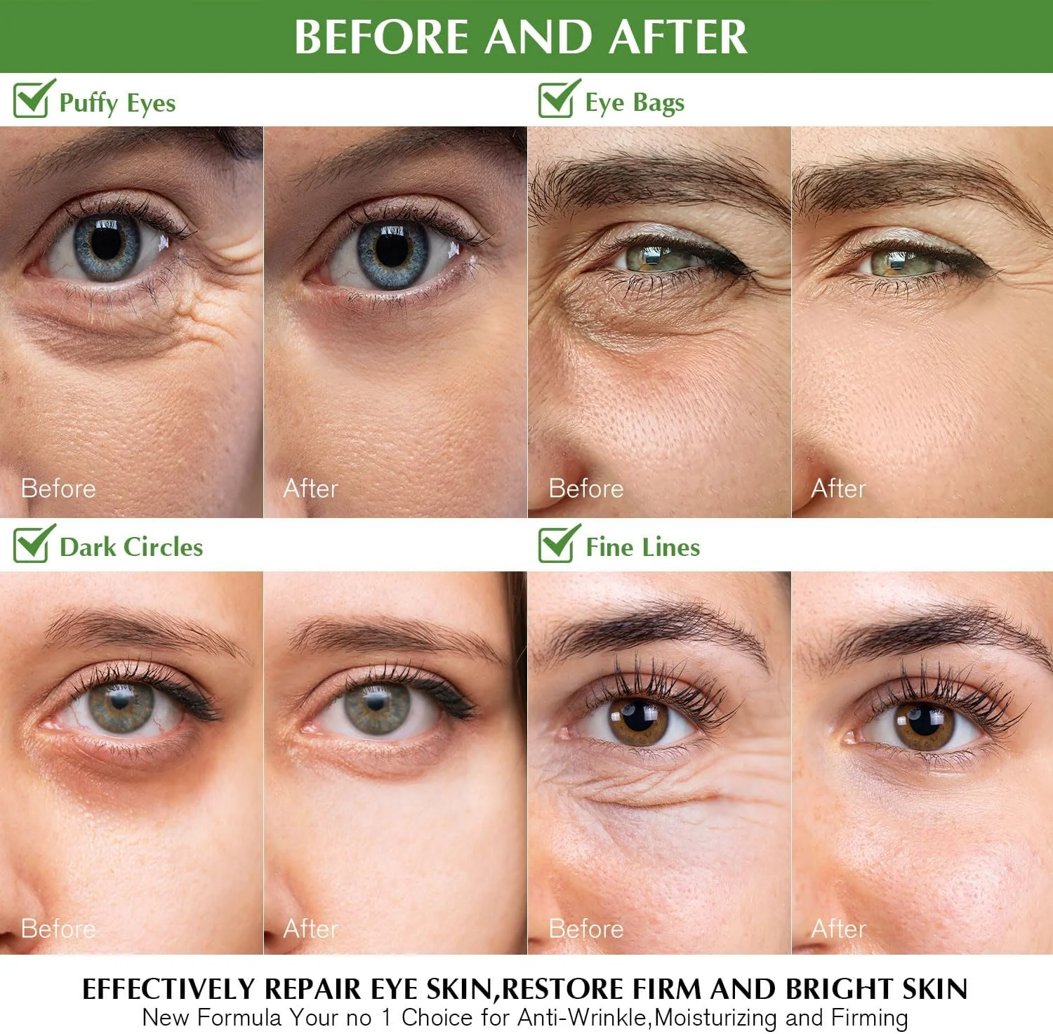 پچ ماسک زیر چشم Enaskin Naturals، پچ های ژلی کلاژن رتینول زیر چشم برای سیاهی و پف، ماسک آبرسان و مرطوب کننده چشم طلای 24 عیار، ضد پیری، ضد چروک، خنک کننده، مناسب سفر و خواب پچ ماسک زیر چشم Enaskin Naturals، پچ های ژلی کلاژن رتینول زیر چشم برای سیاهی و پف، ماسک آبرسان و مرطوب کننده چشم طلای 24 عیار، ضد پیری، ضد چروک، خنک کننده، مناسب سفر و خواب